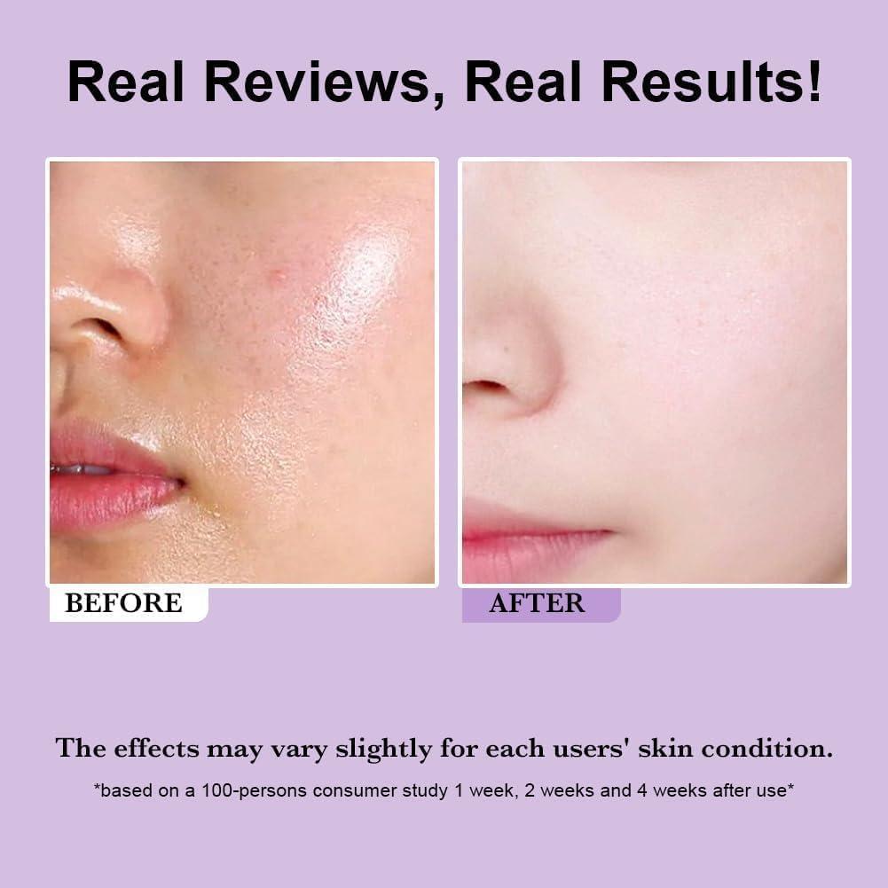 Tónico Exfoliante AHA/BHA COSMOO 150ml para Todo Tipo de Piel