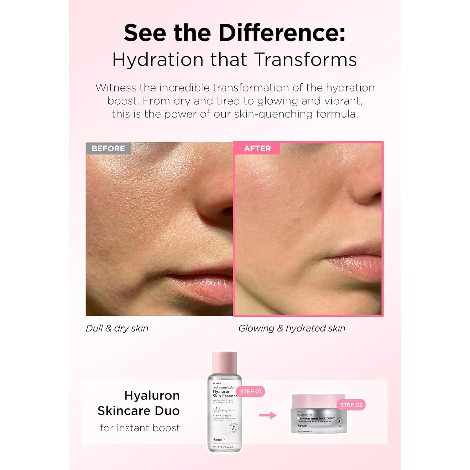 Esencia Hidratante Hanskin Hyaluron 240g - Ácido Hialurónico