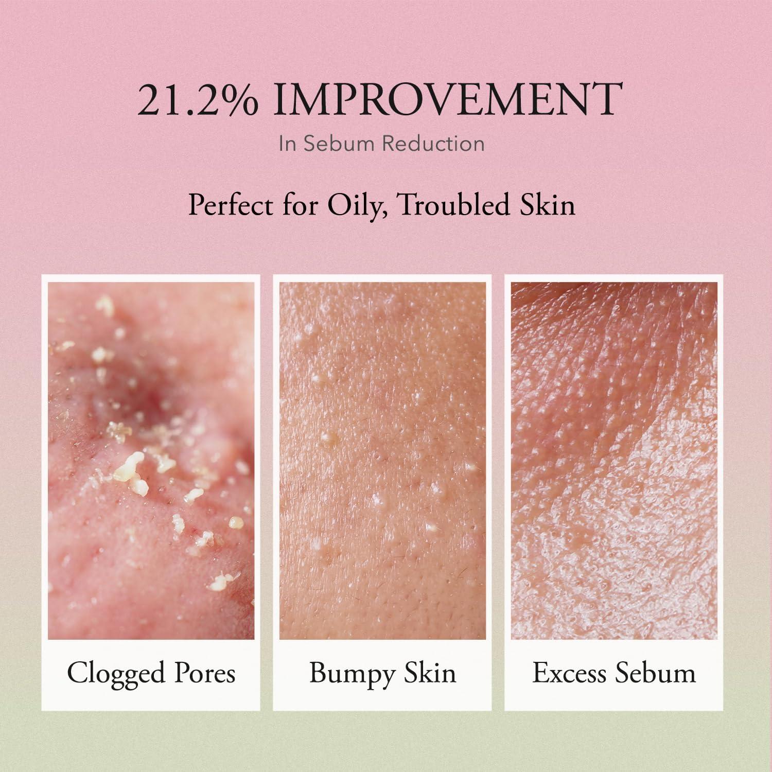 Tónico Facial Aloe Vera Rosa Aprilskin 250 ml Hidratante