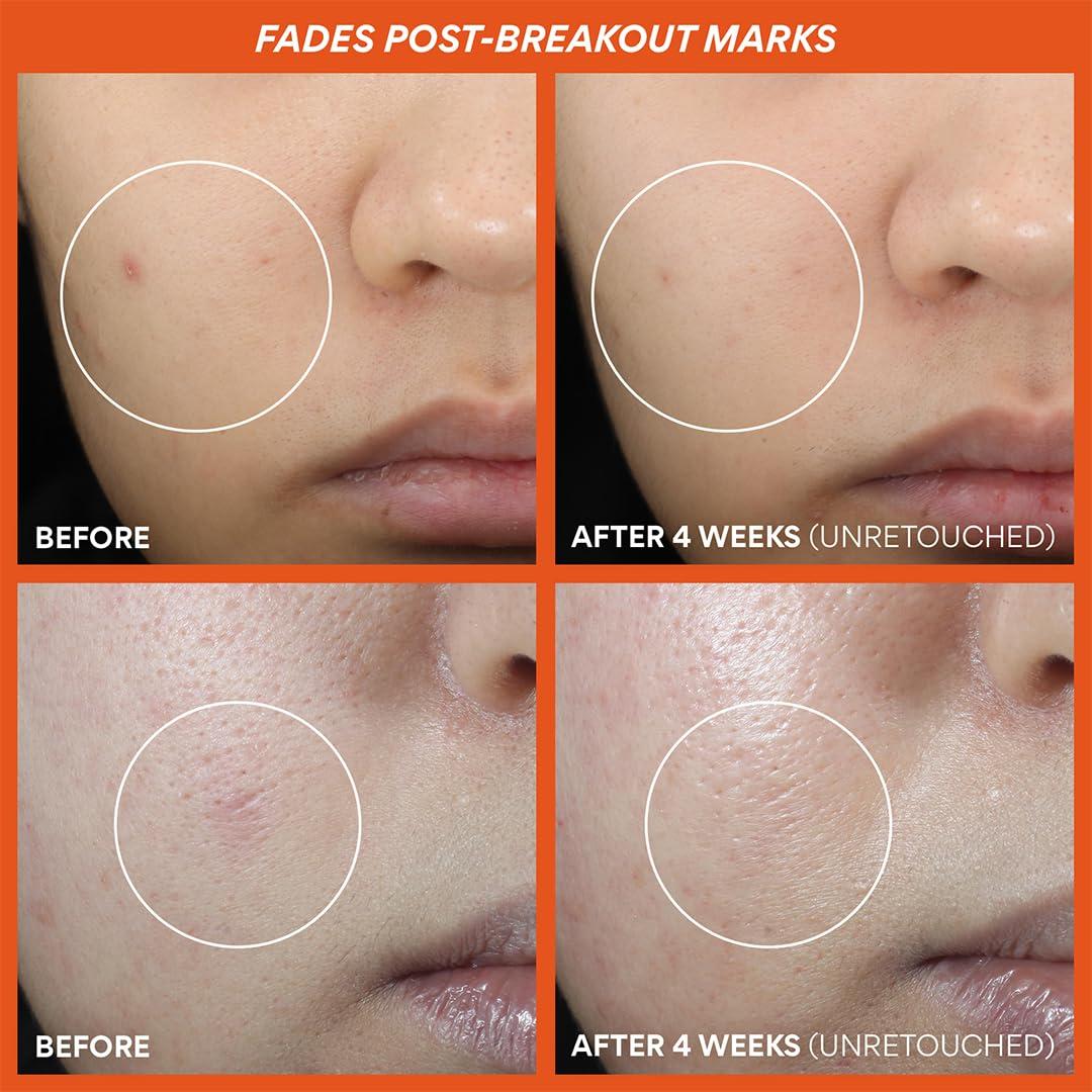 Discos Tónicos Iluminadores Innisfree Vitamina C 295g