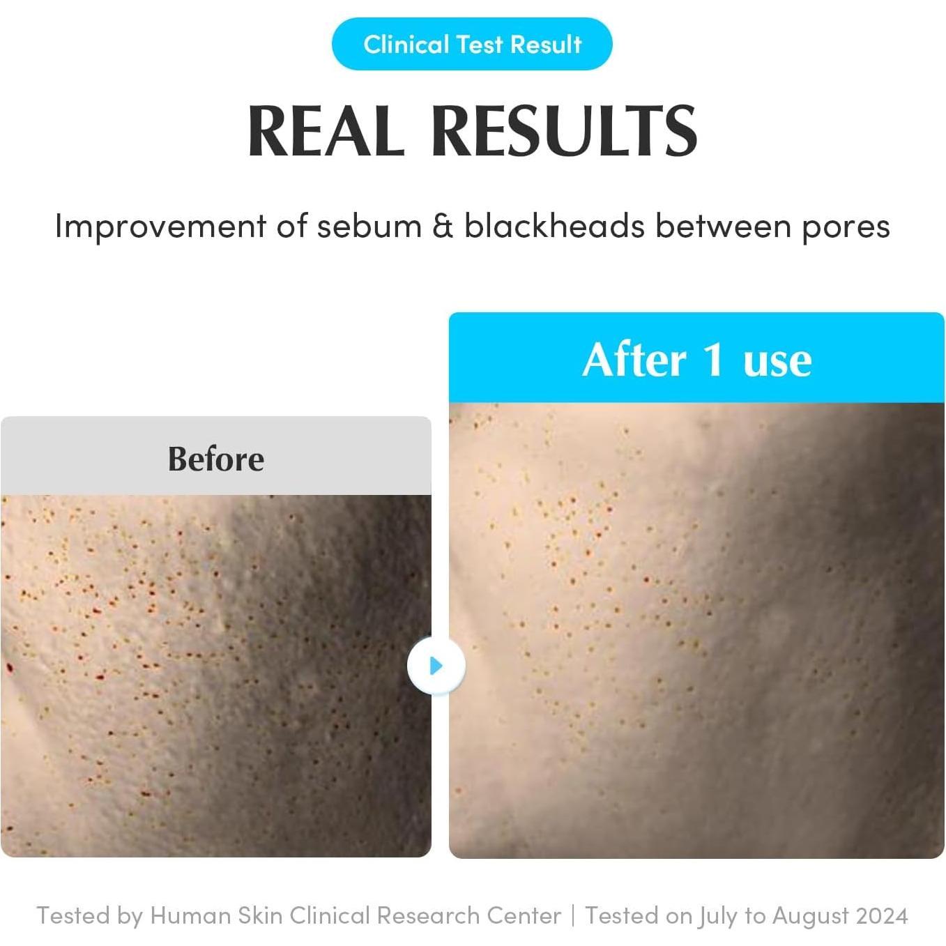 Discos de Tónico Doble Textura TheOne - 70 Unidades