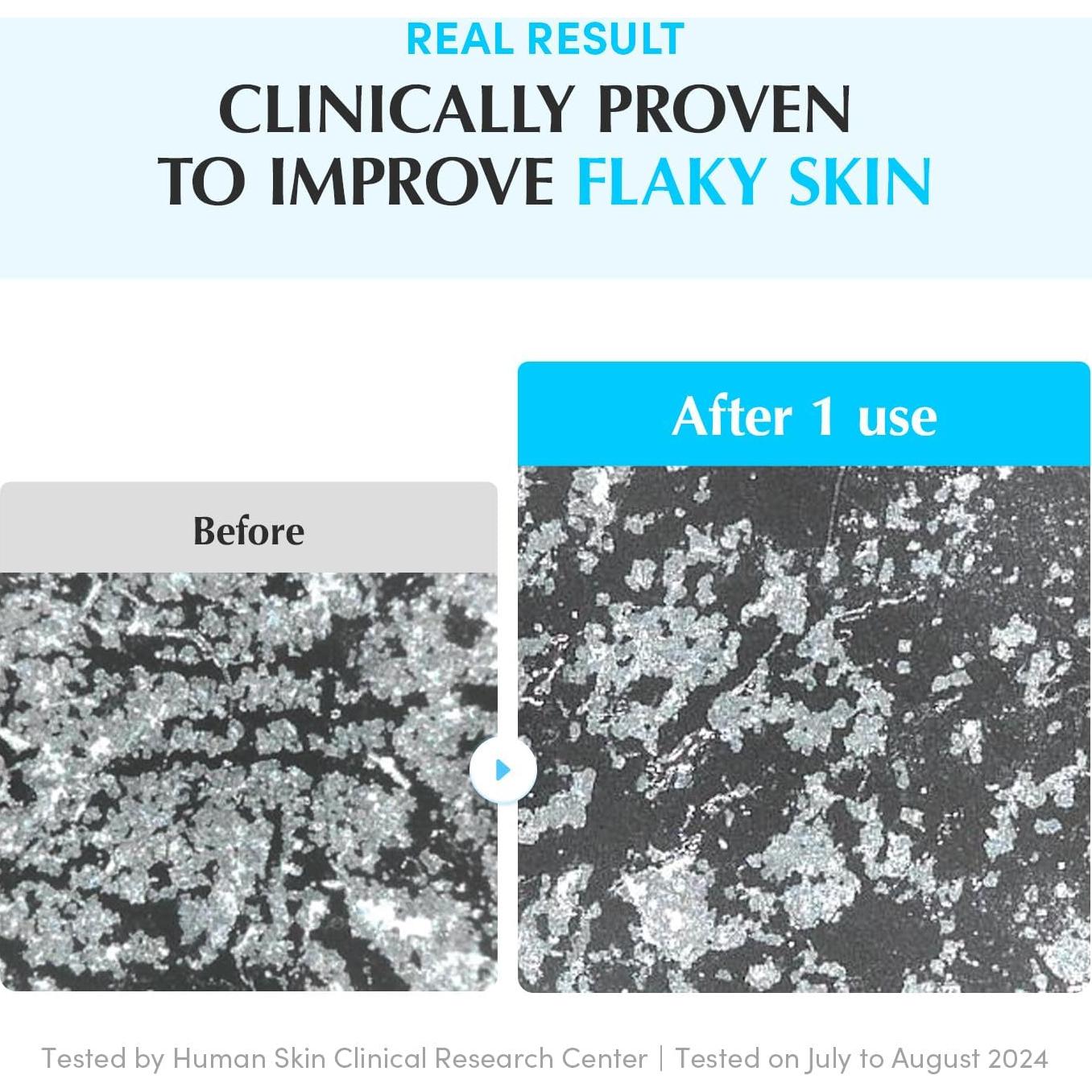 Discos de Tónico Doble Textura TheOne - 70 Unidades