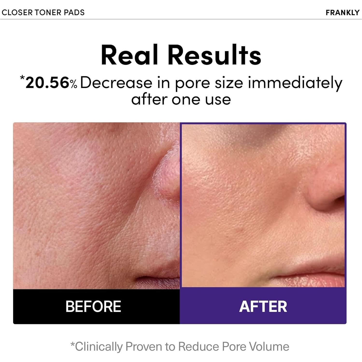 Almohadillas Tonificantes Frankly con Extracto de Arroz 9 Péptidos