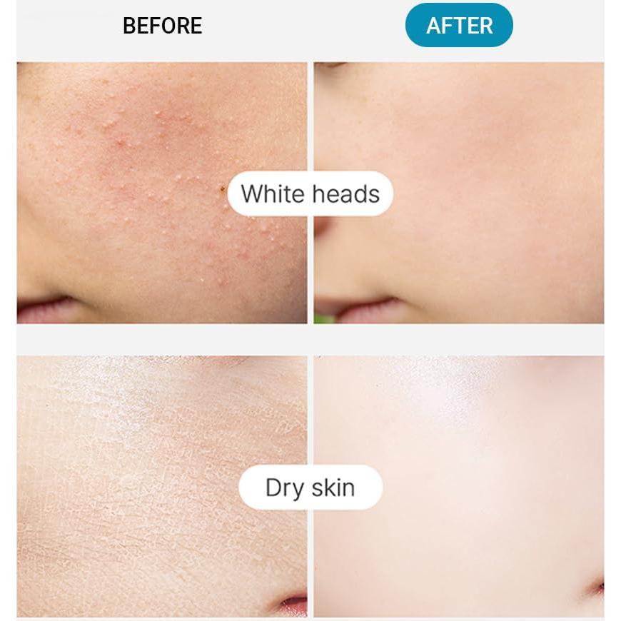 TENZERO Almohadillas Tonificantes de Colágeno 70ea 100% Algodón