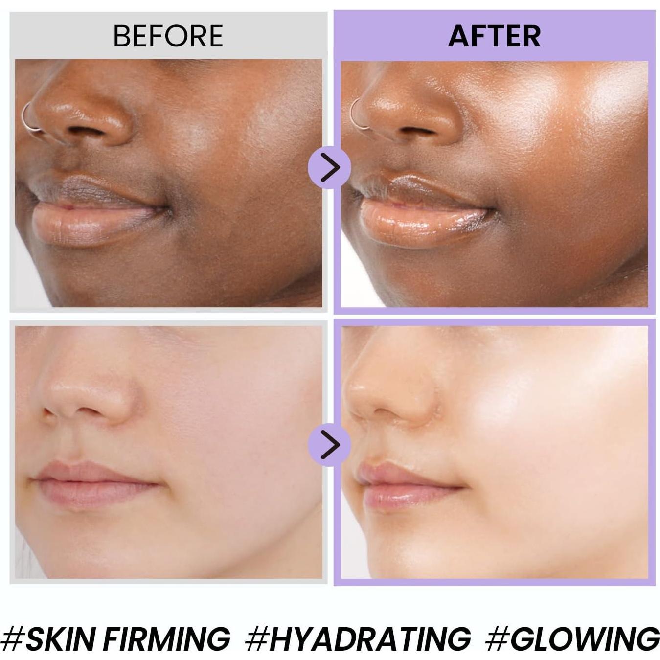 Tonificador de Colágeno de Caracol Coxir 150ml Hidratante