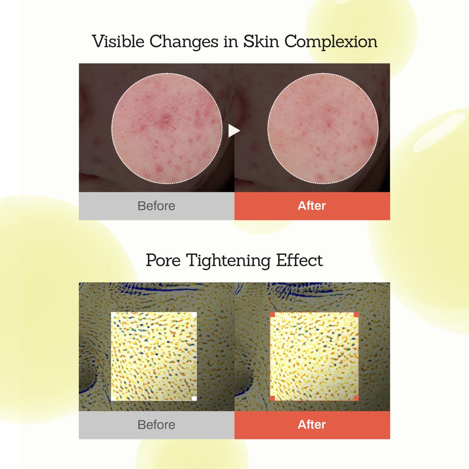 Suero Facial MEDITHERAPY Retinal 150ml Piel Sensible