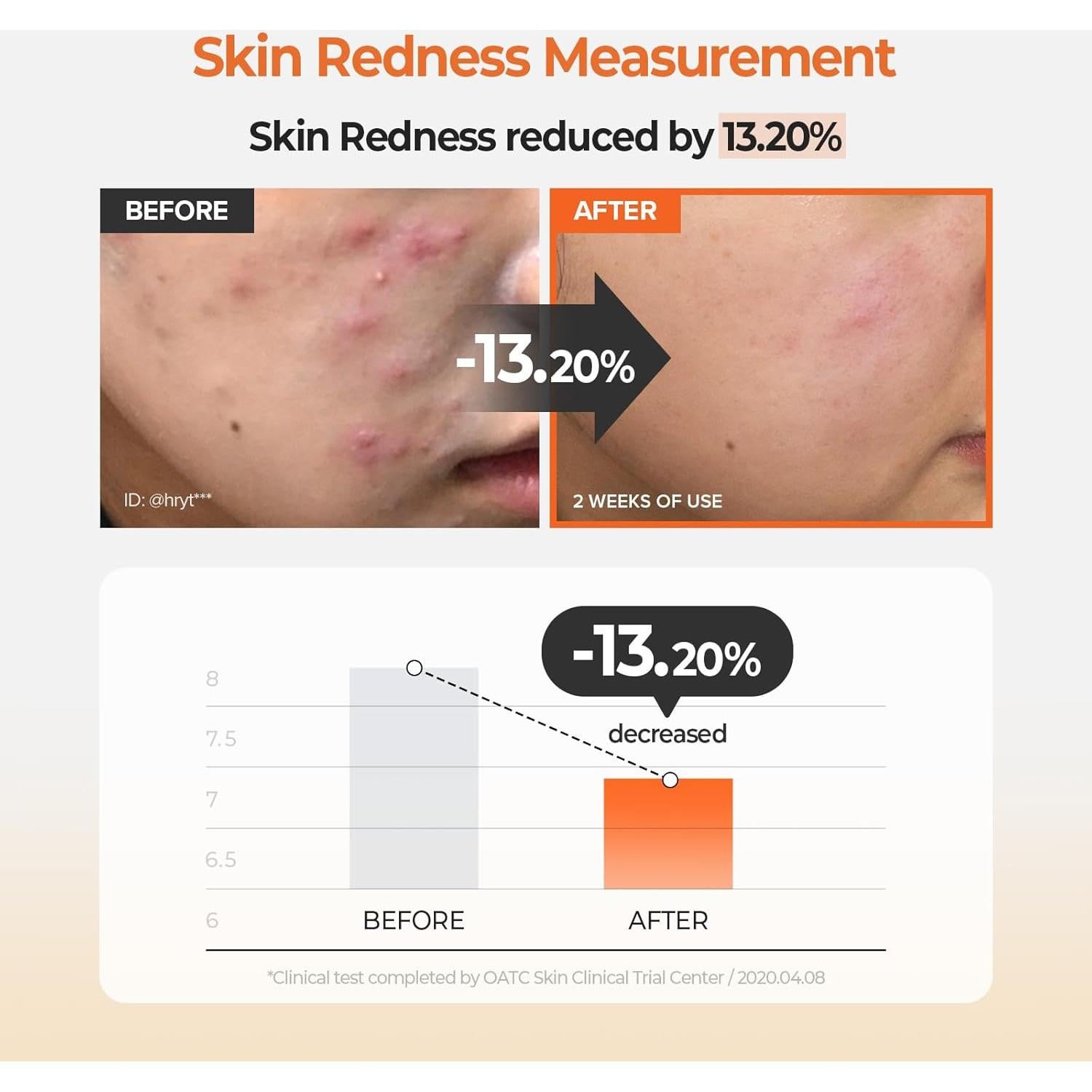 Almohadillas Calmantes Skinfood Zanahoria 250g - 60 Hojas