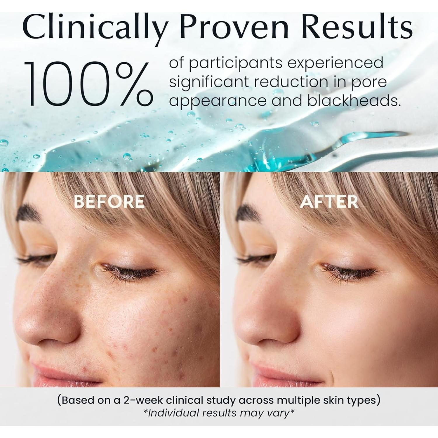 Discos Tónicos Coreanos La Pure 100 Ct - Hidratantes y Exfoliantes