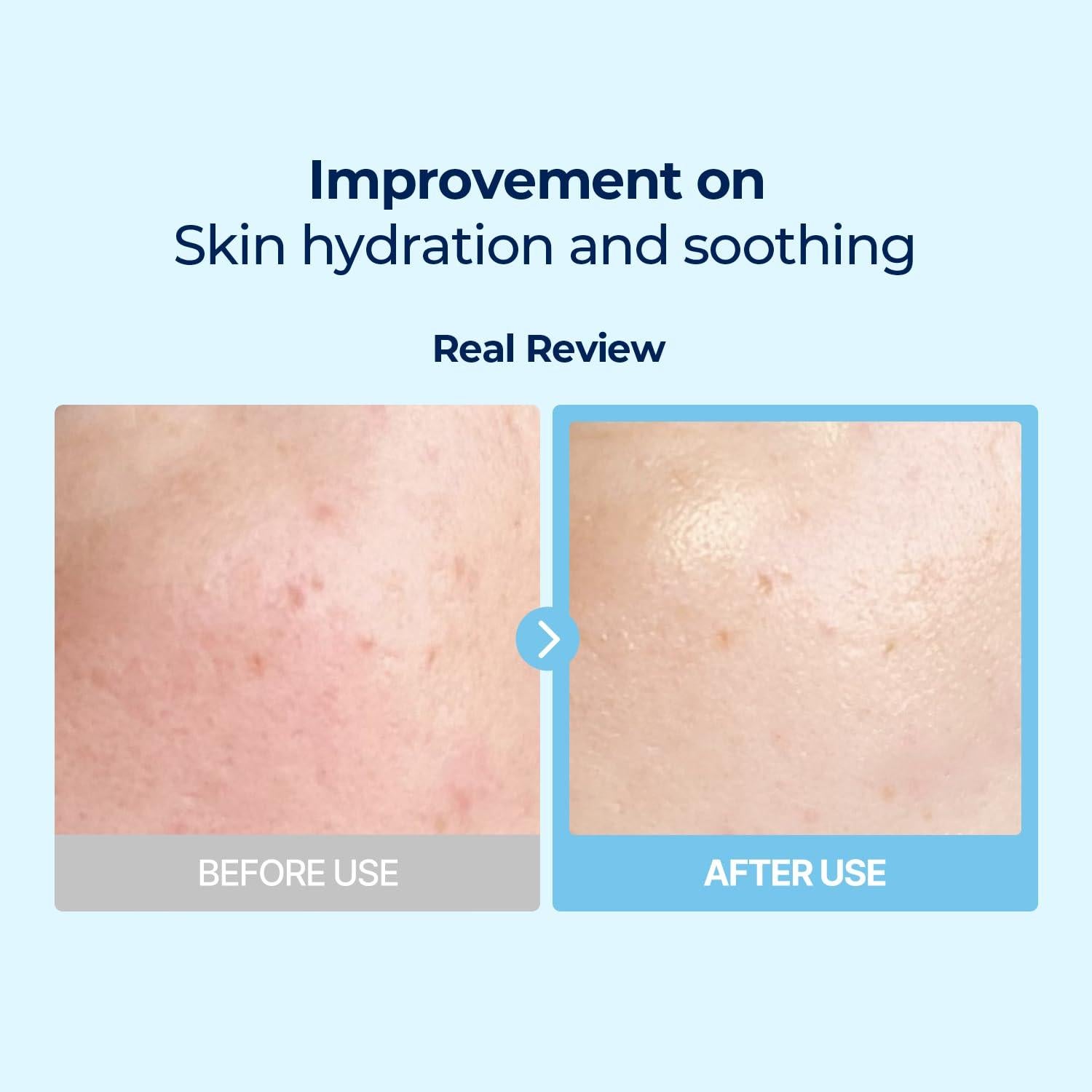 Torriden DIVE IN Almohadillas Faciales 80 Pads Ácido Hialurónico