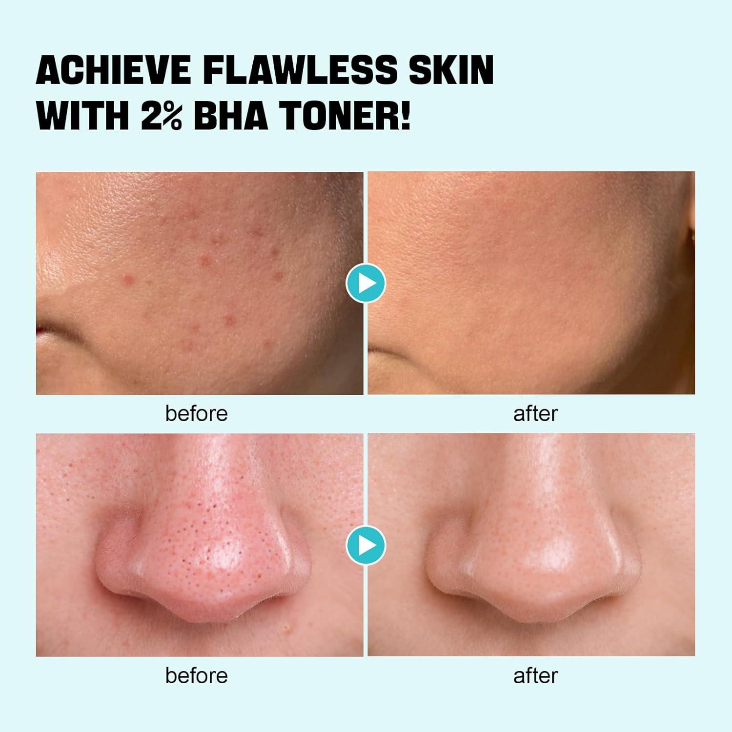 Tónico Facial BHA ZealSea 200ml Exfoliante Sin Alcohol