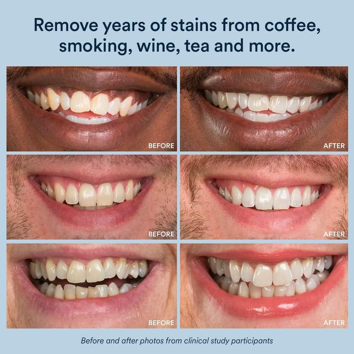 Bolígrafo Blanqueador de Dientes Auraglow 4mL 9% Peróxido