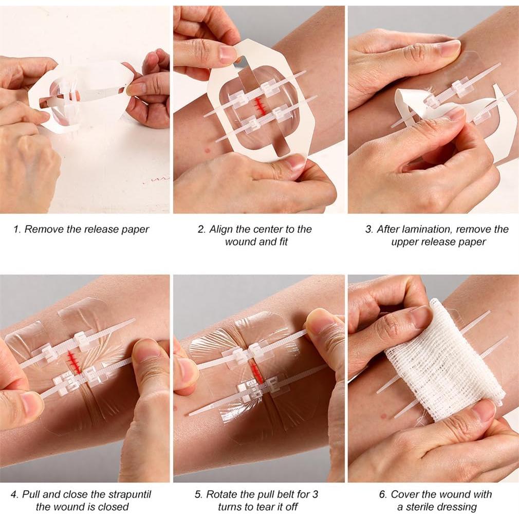 Kit de Cierre de Heridas de Emergencia Yeasing 2 Piezas 6x7cm