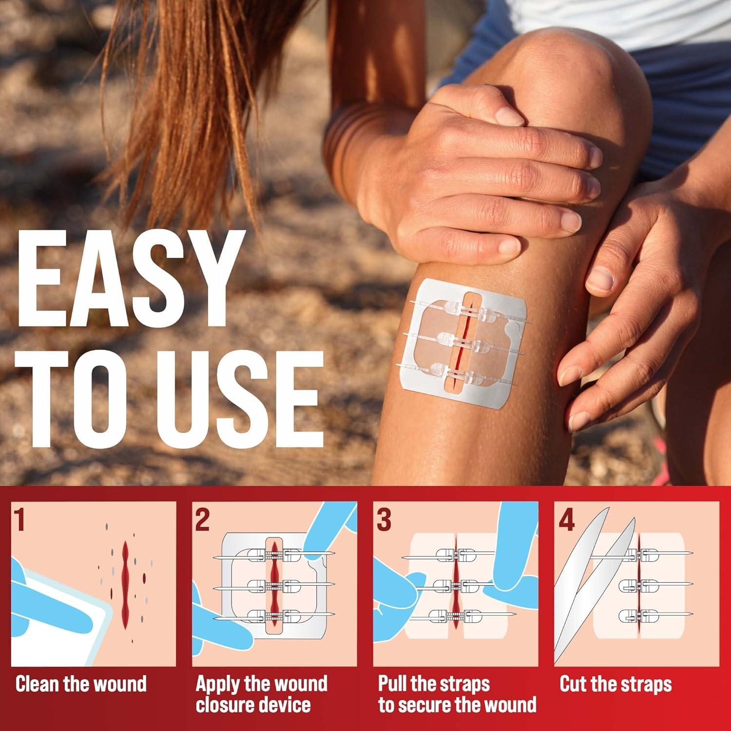 Tiras de Cierre de Heridas MyHelp - Kit 4 Piezas