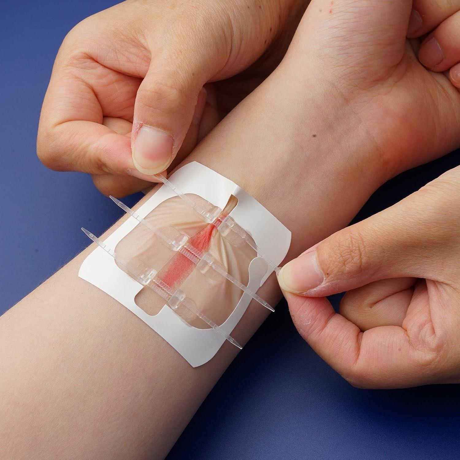 Cinta de Cierre de Heridas FORKANG 6 Cremalleras 6,1x10,4 cm