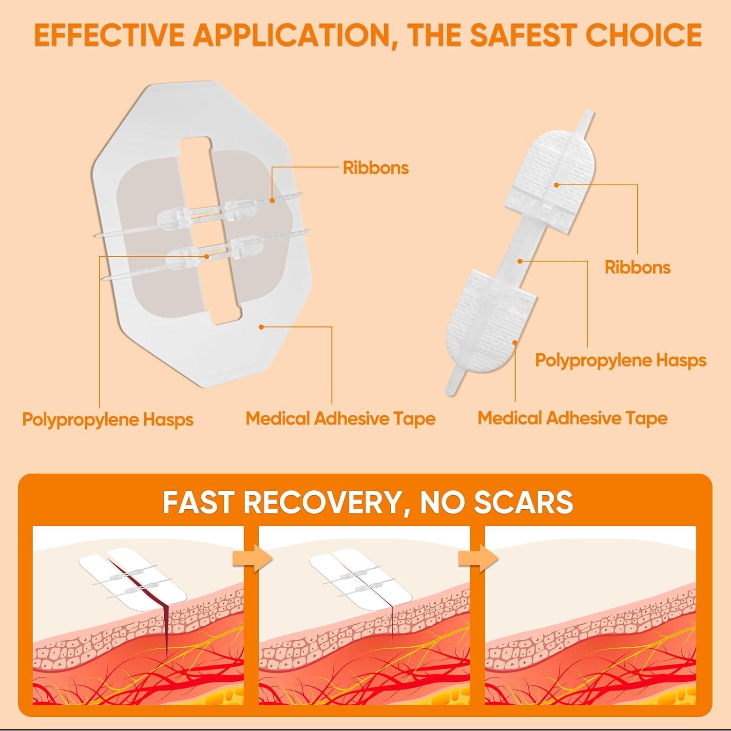 Tiritas Butterfly JOLVKA - Kit de Cierre de Heridas 5 pzas