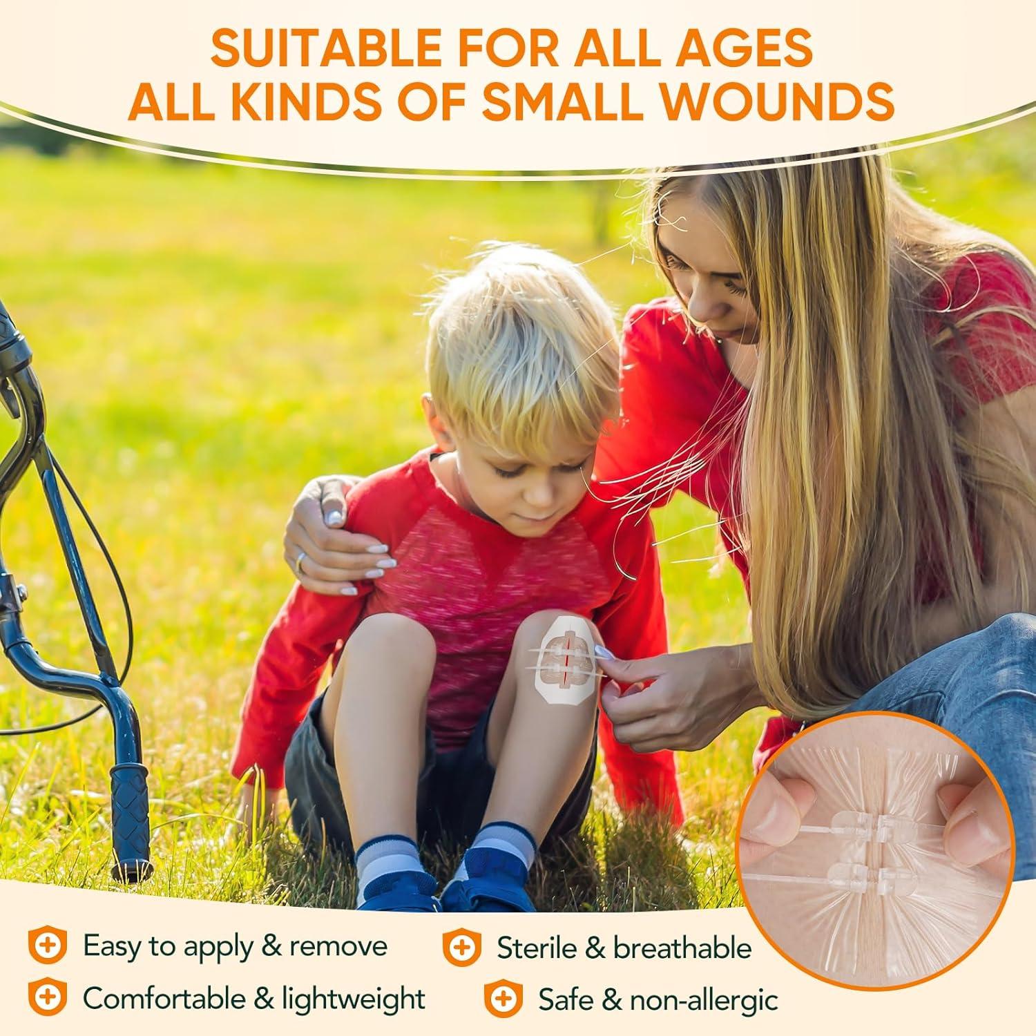 Tiritas Butterfly JOLVKA - Kit de Cierre de Heridas 5 pzas