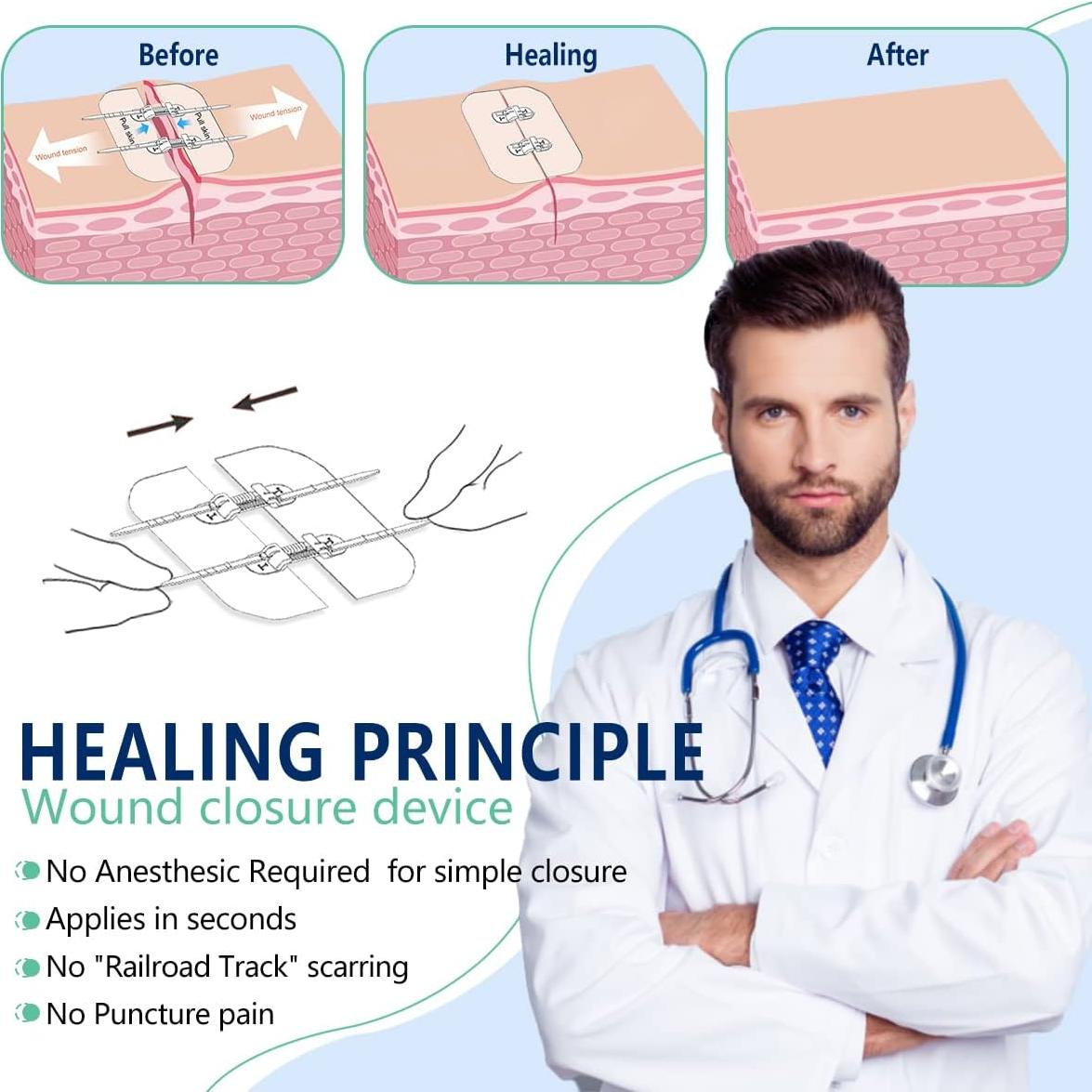 Dispositivo de Cierre de Heridas ArixMed - Kit de Emergencia (2 Pzs)