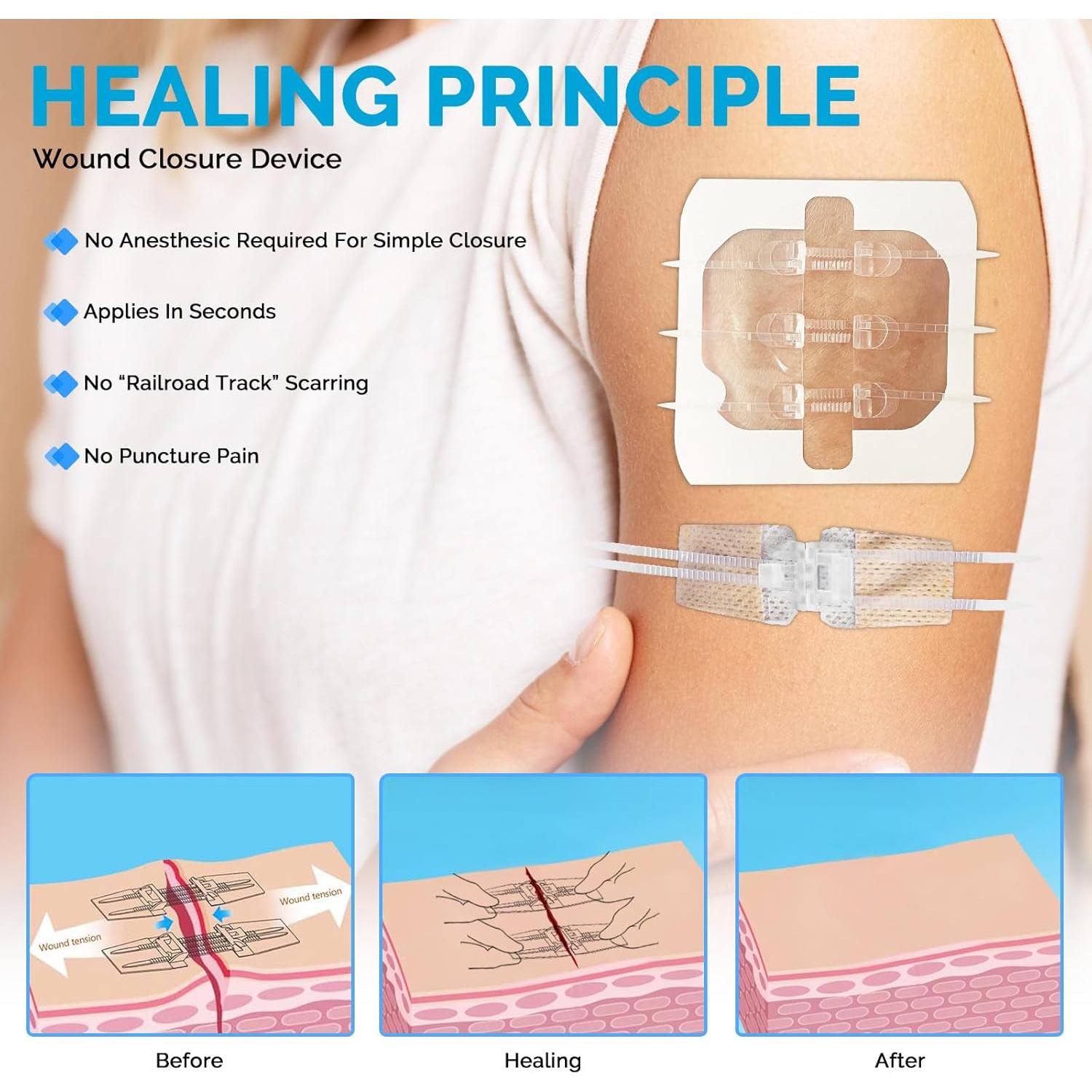 Kit de Cierre de Heridas Greetmed - 16 Piezas de Emergencia