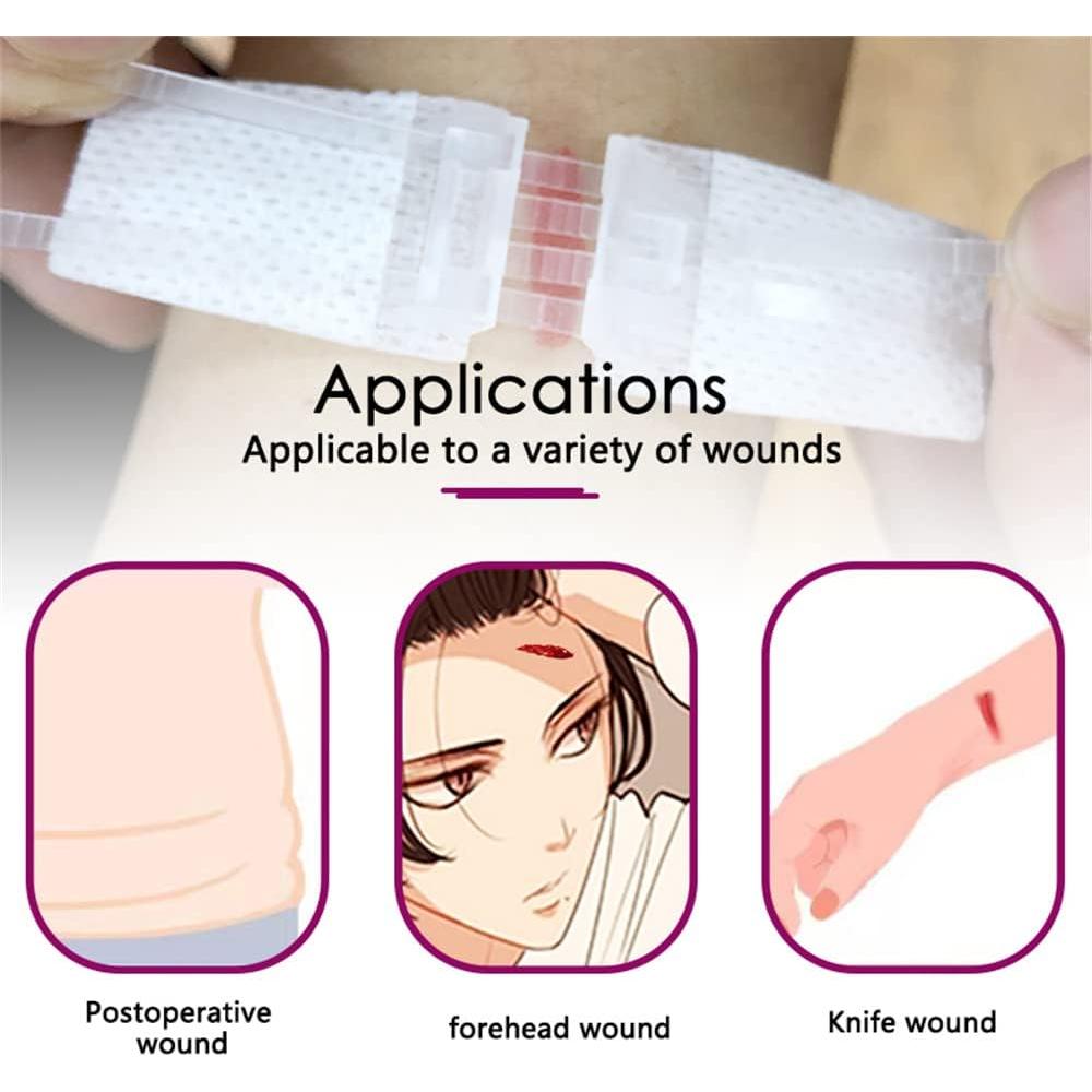 Kit de Cierre de Heridas JCMED 2 Piezas Sin Suturas