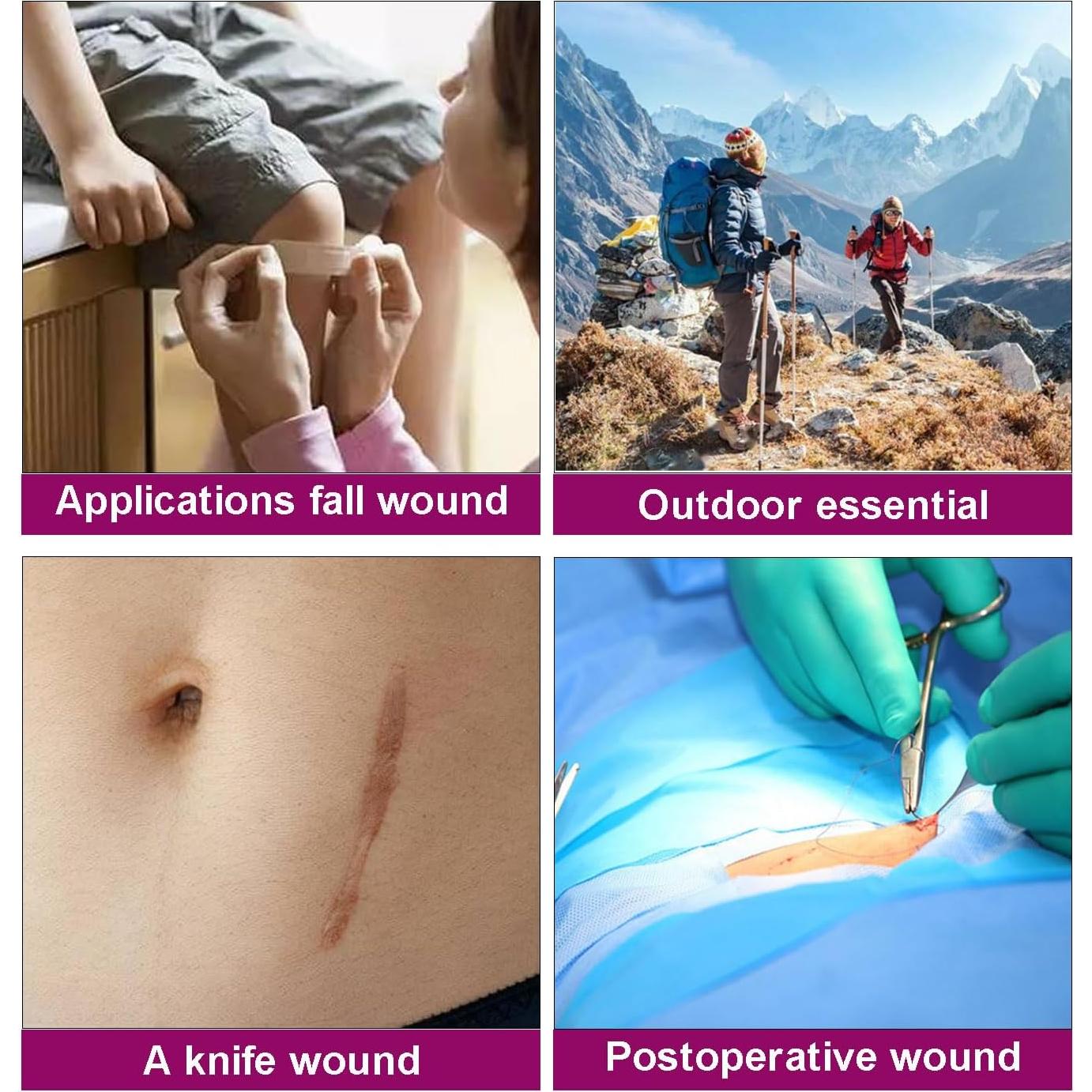 Kit de Cierre de Heridas JCMED 2 Piezas Sin Suturas