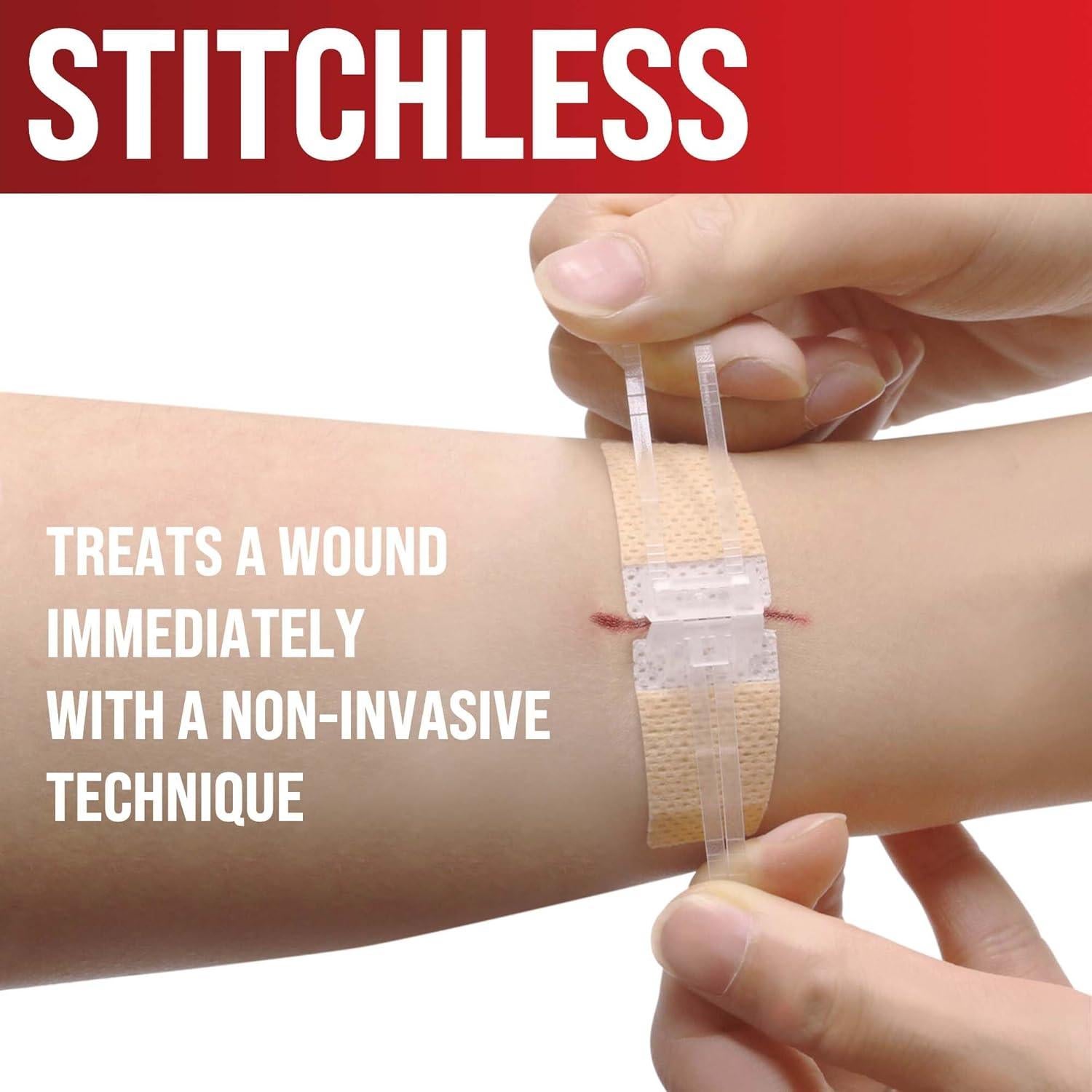 Kit de Cierre de Heridas MyHelp - Vendaje Mariposa 1-Pack