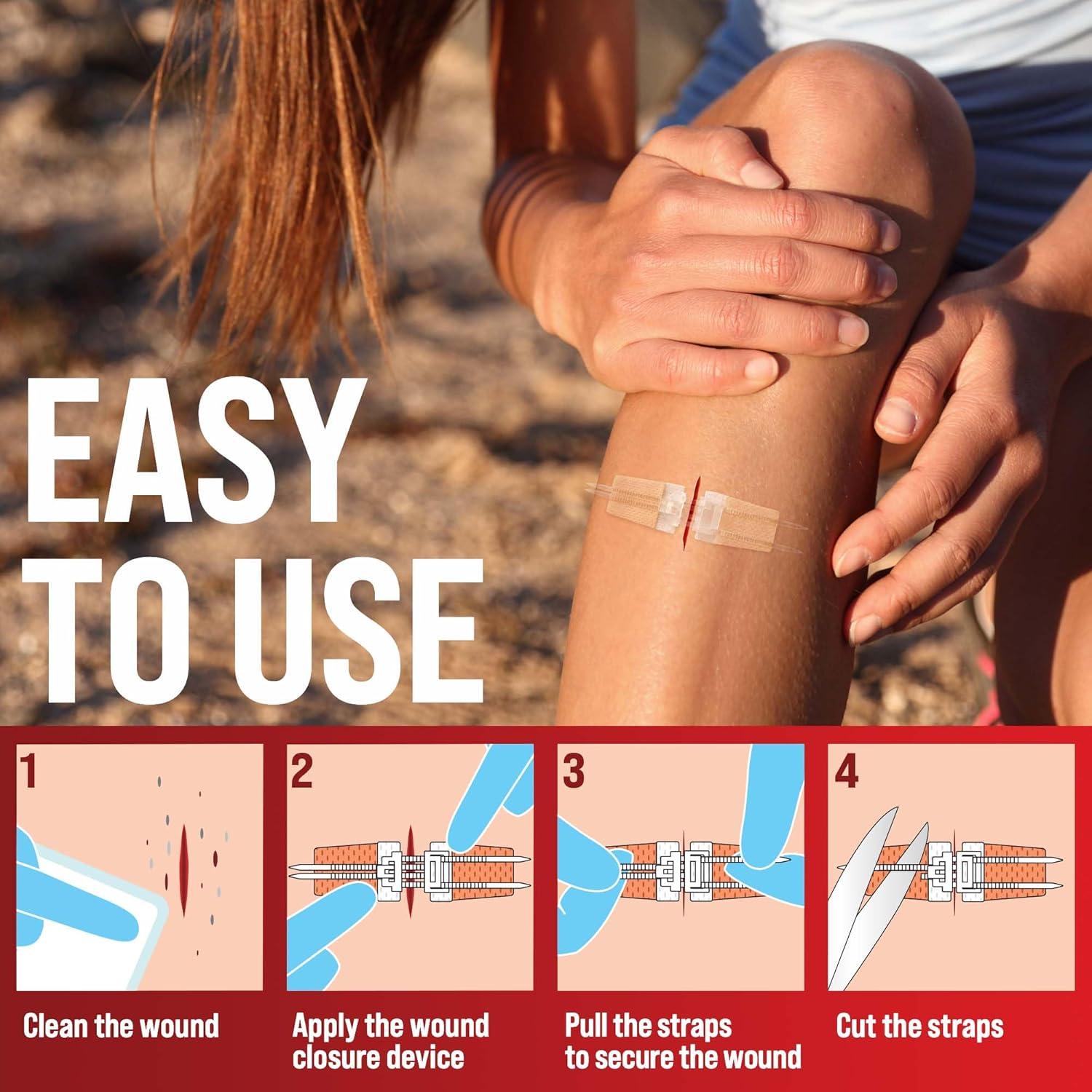 Kit de Cierre de Heridas MyHelp - Vendaje Mariposa 1-Pack