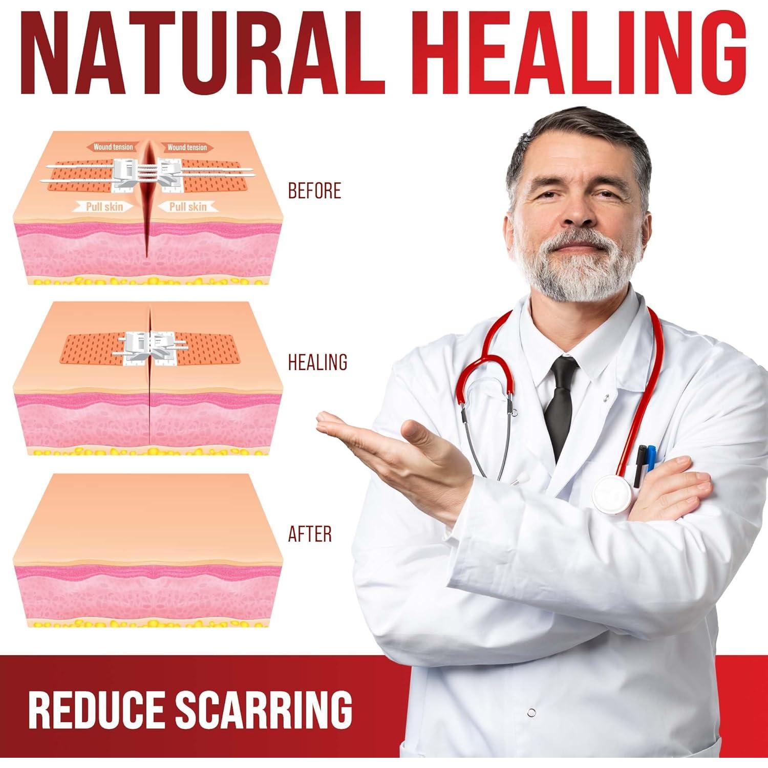 Kit de Cierre de Heridas MyHelp - Vendaje Mariposa 1-Pack