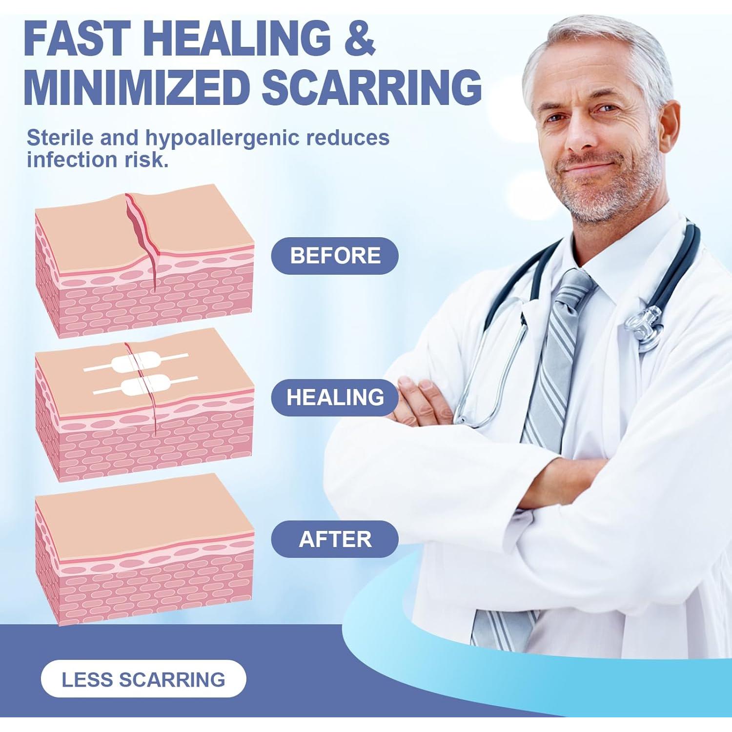 Kit de Cierre de Heridas AID MATE 6 Piezas Sin Suturas