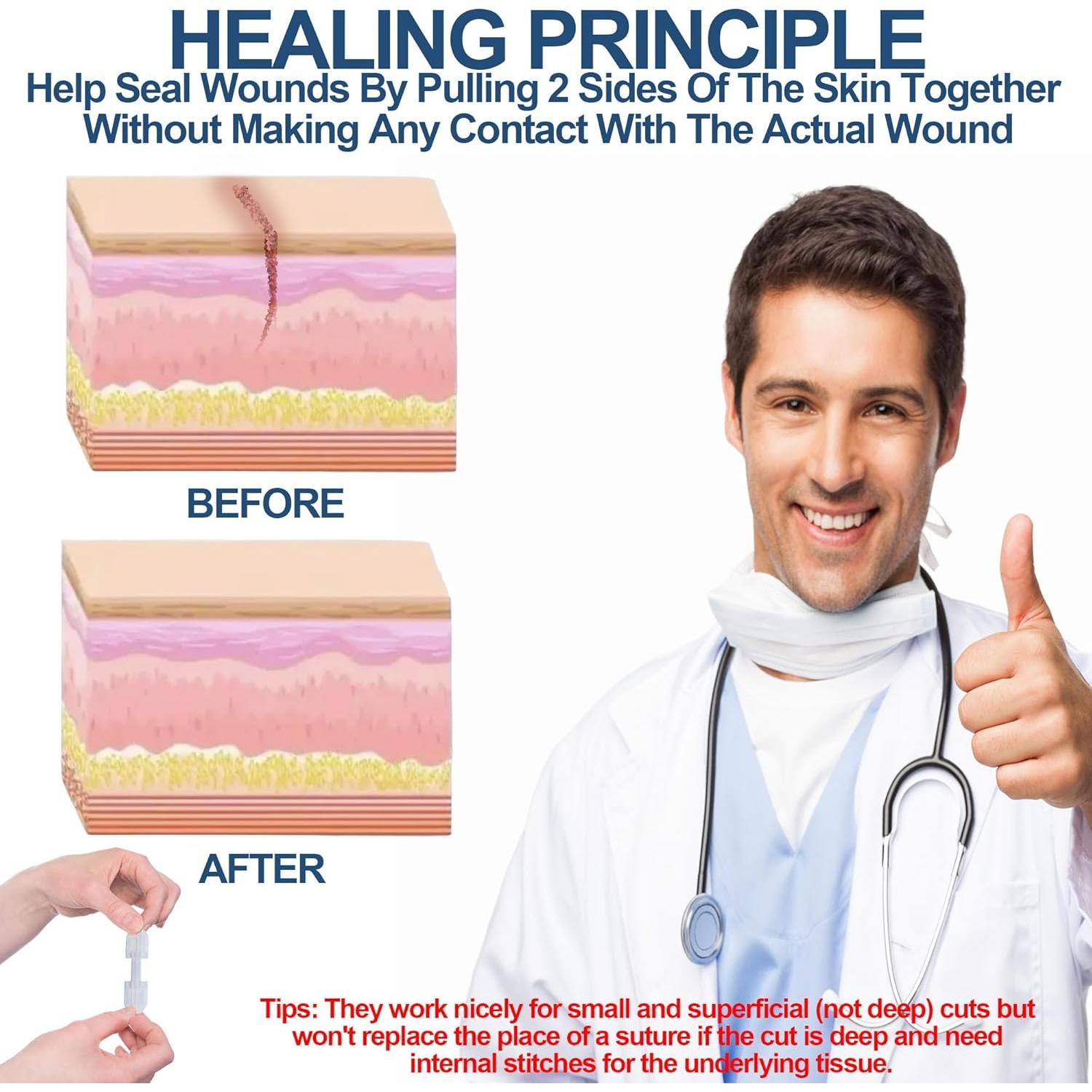 Kit de Tiras de Cierre de Heridas MediMatic - 3 Unidades