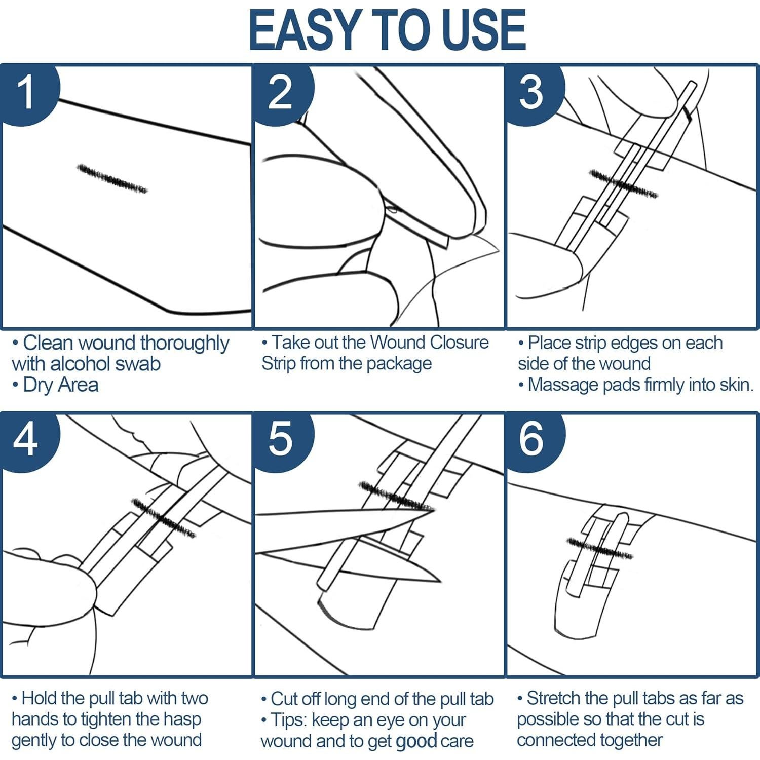 Kit de Tiras de Cierre de Heridas MediMatic - 3 Unidades