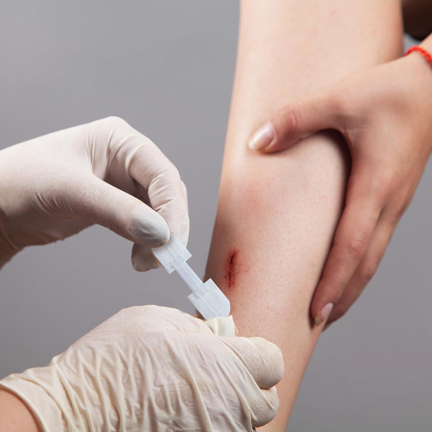 Kit de Tiras de Cierre de Heridas MediMatic - 3 Unidades