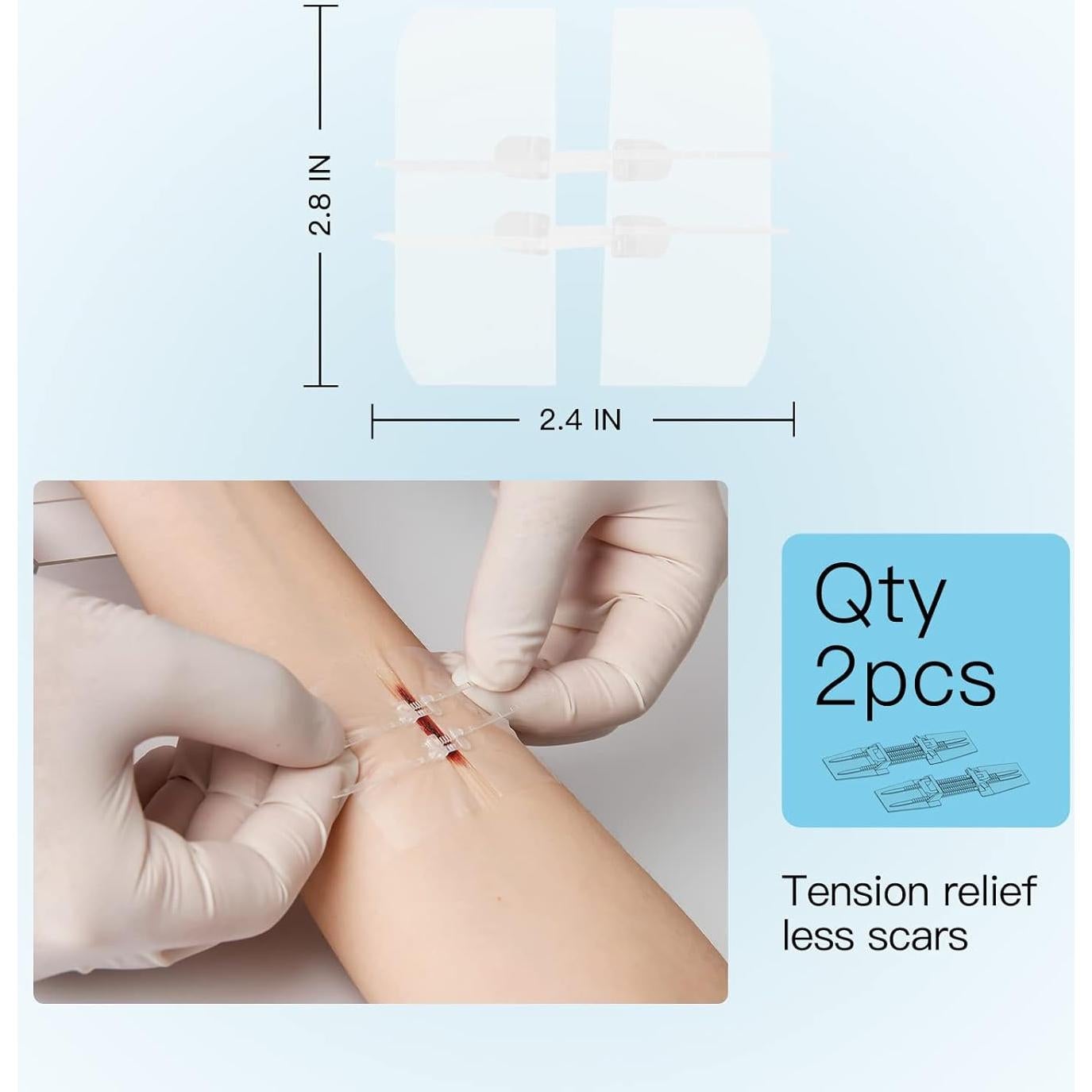 Cierre de Heridas Sin Puntos MaiWieel 2 Piezas 15x10cm