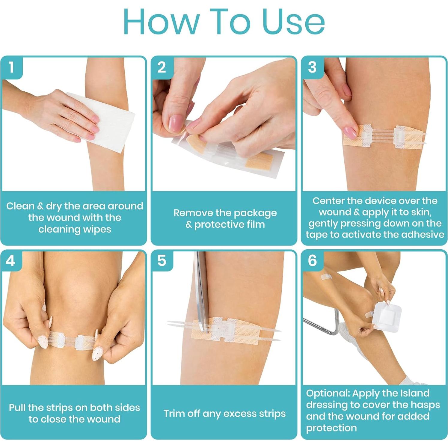 Kit de Cierre de Heridas ViveCare 4 Pcs - Vendajes Estériles