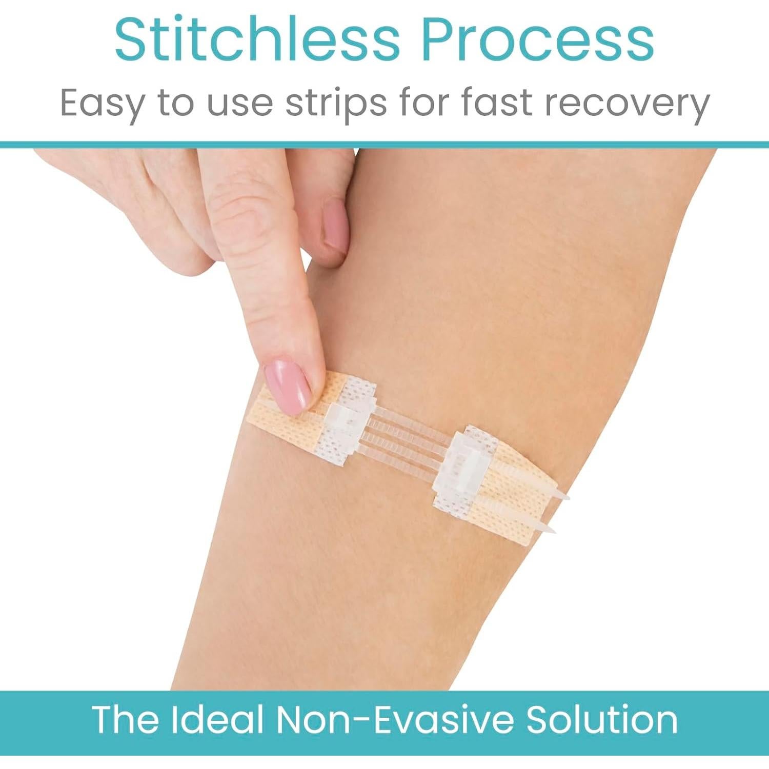 Kit de Cierre de Heridas ViveCare 4 Pcs - Vendajes Estériles