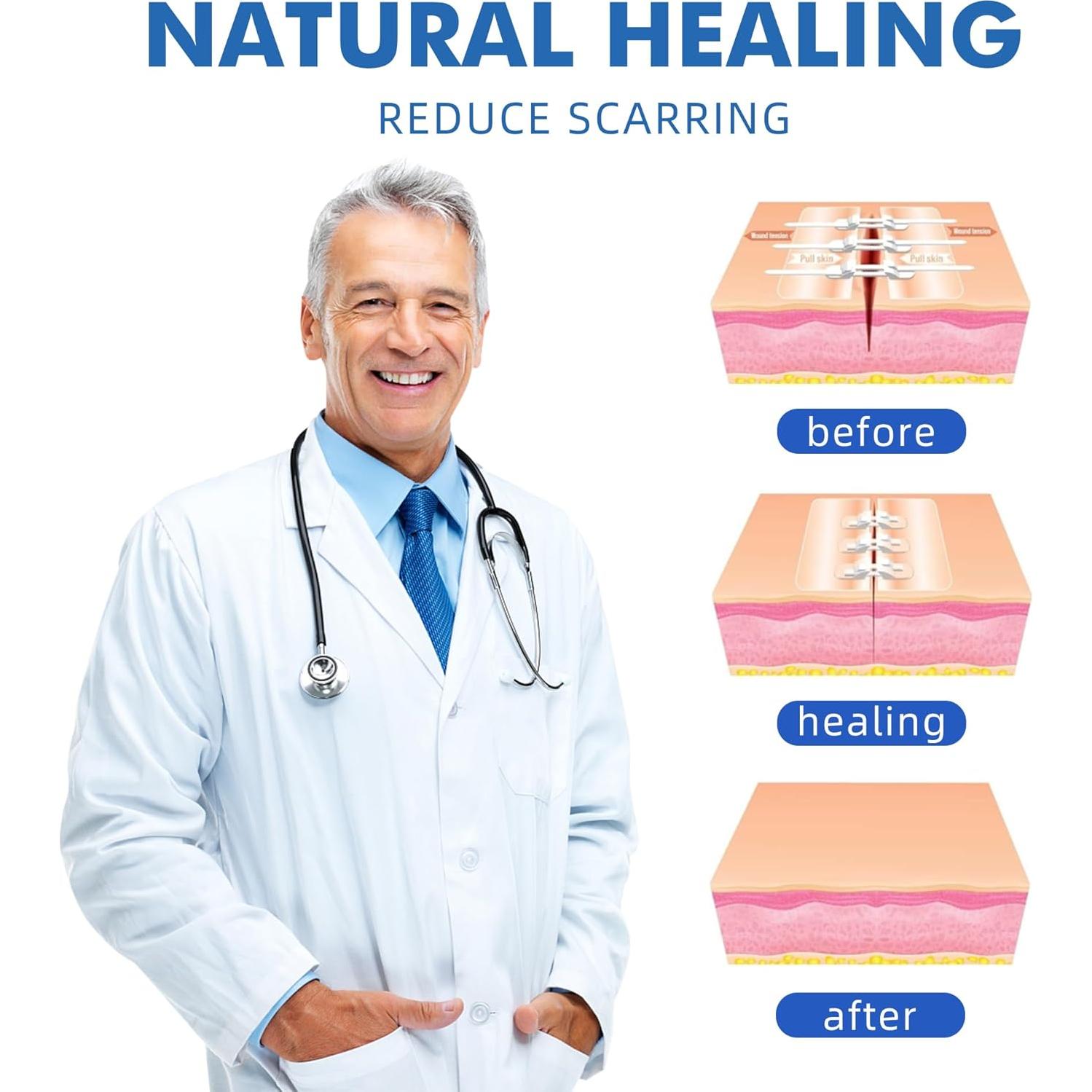 Cierres de Laceración de Emergencia 2 Pcs PU - Tiritas Mariposa