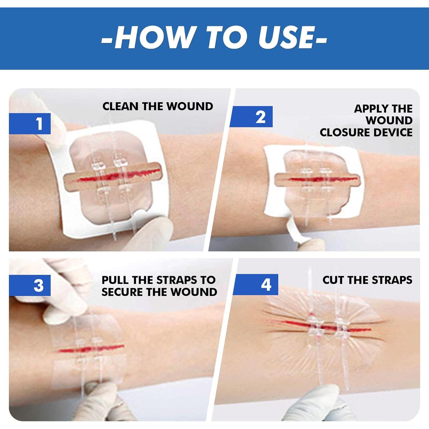 Cierres de Laceración de Emergencia 2 Pcs PU - Tiritas Mariposa