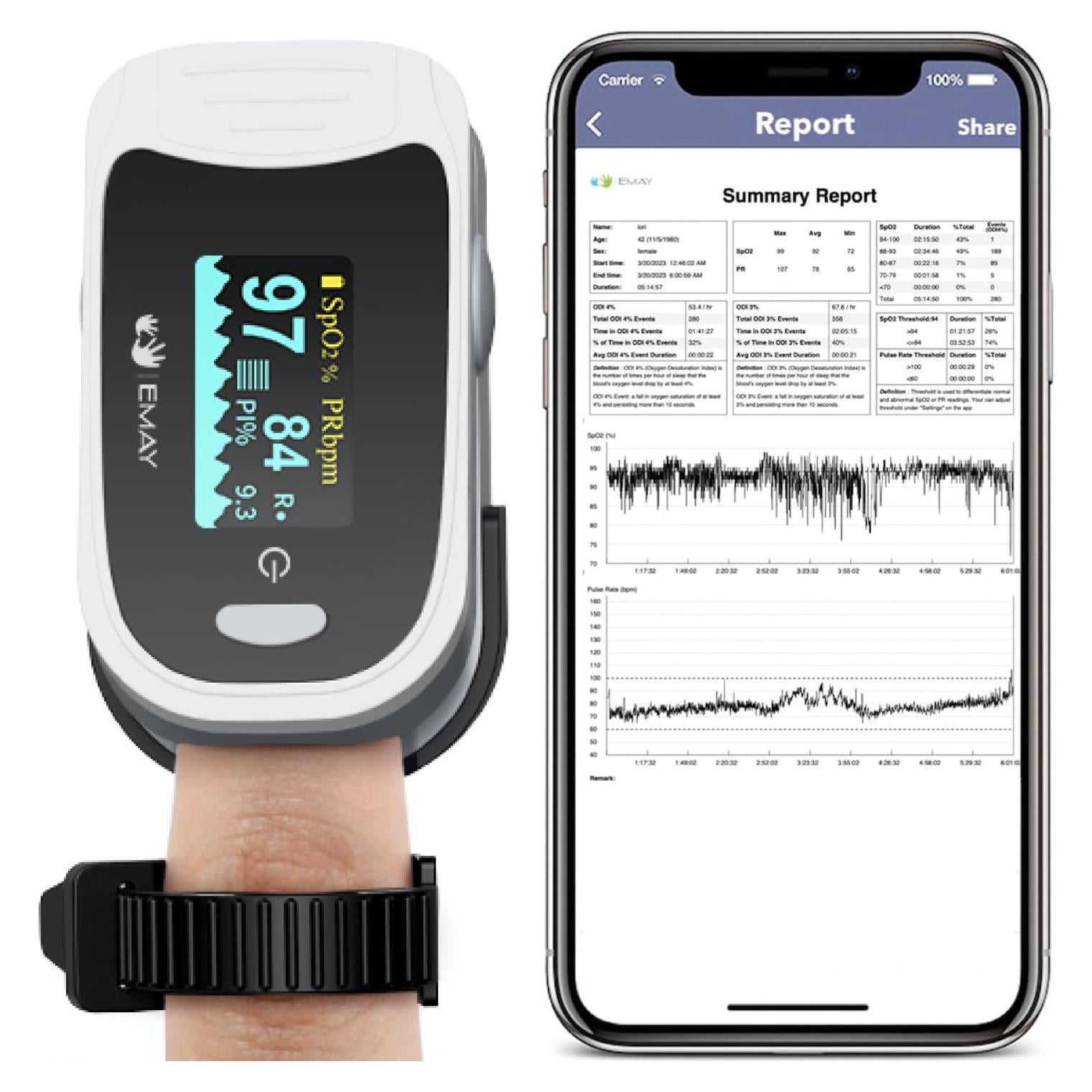 Monitor de Oxígeno EMAY EMO-80 con Grabación y App