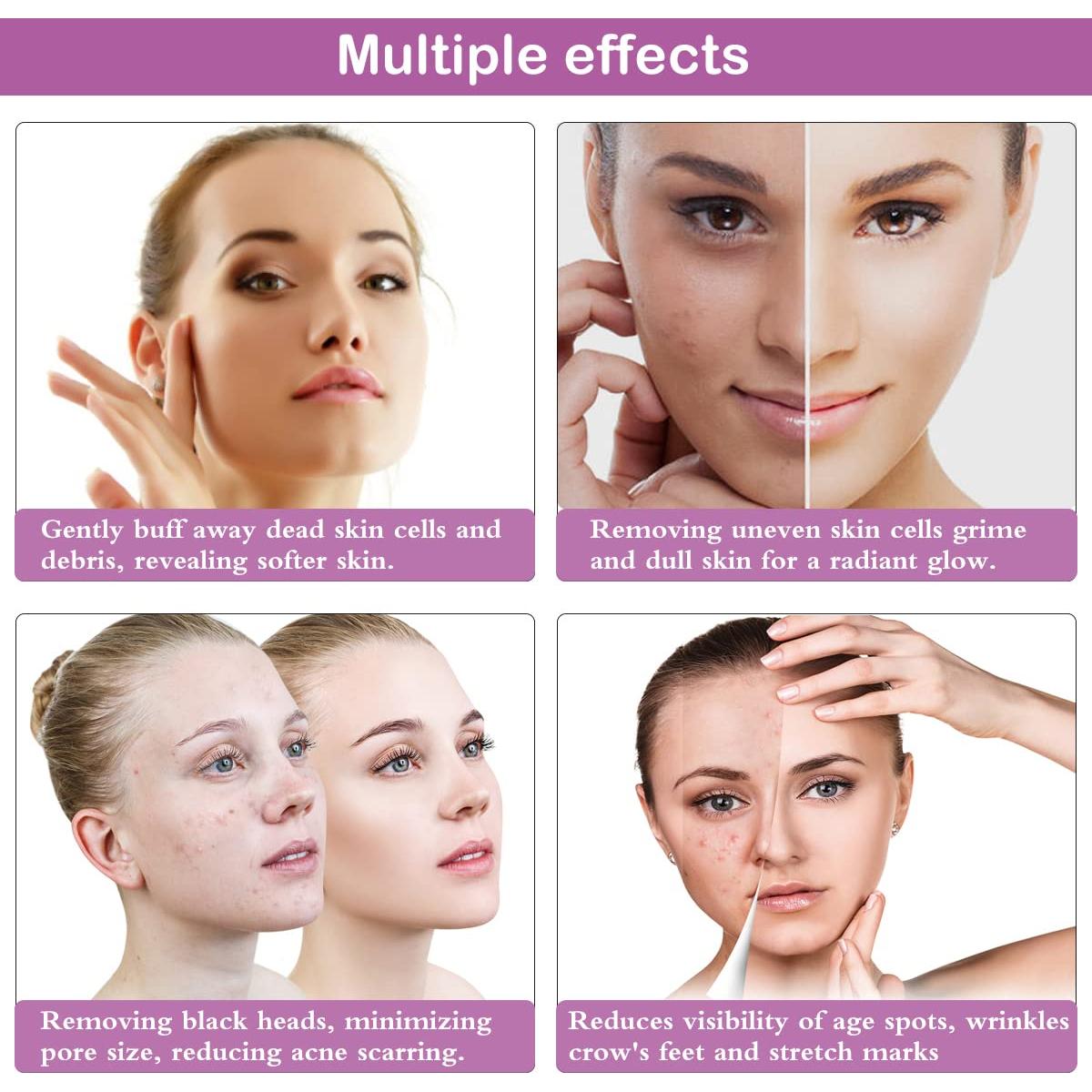 Máquina de Microdermoabrasión Yofuly, 17 Piezas, 65-68 cmHg