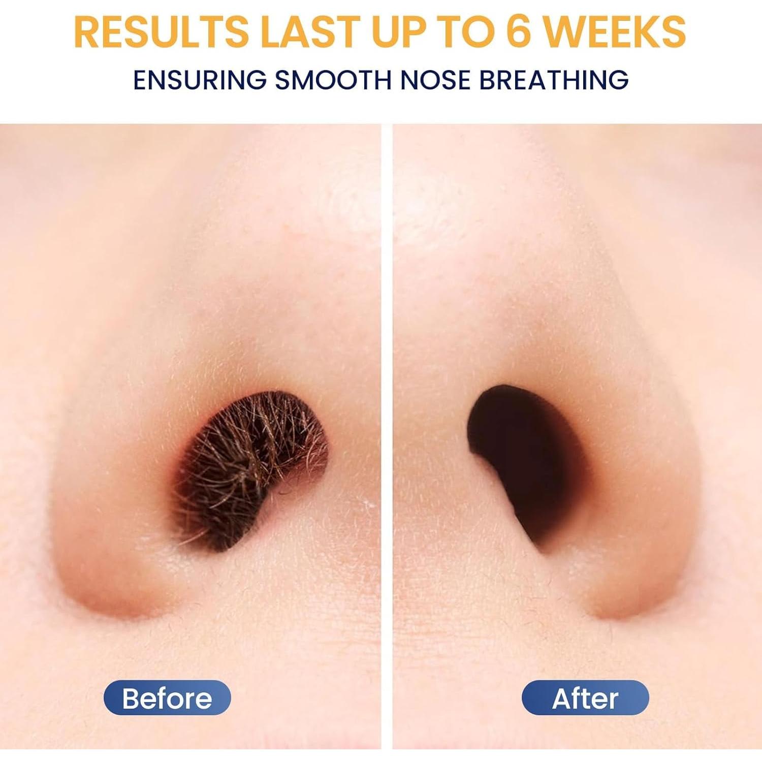 Kit de Cera para Nariz Suerbeaty - 100g, 30 Aplicadores, USB