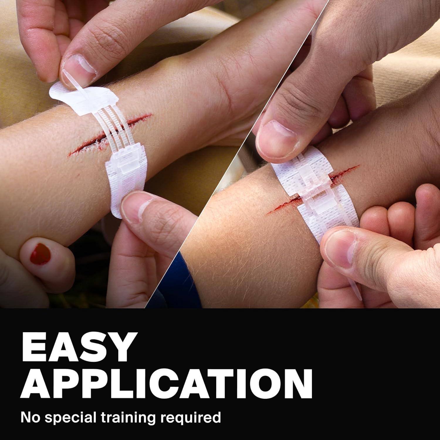 Cierres de Heridas Zip Stitch SurviveX - 3 PCS - Sin Puntos