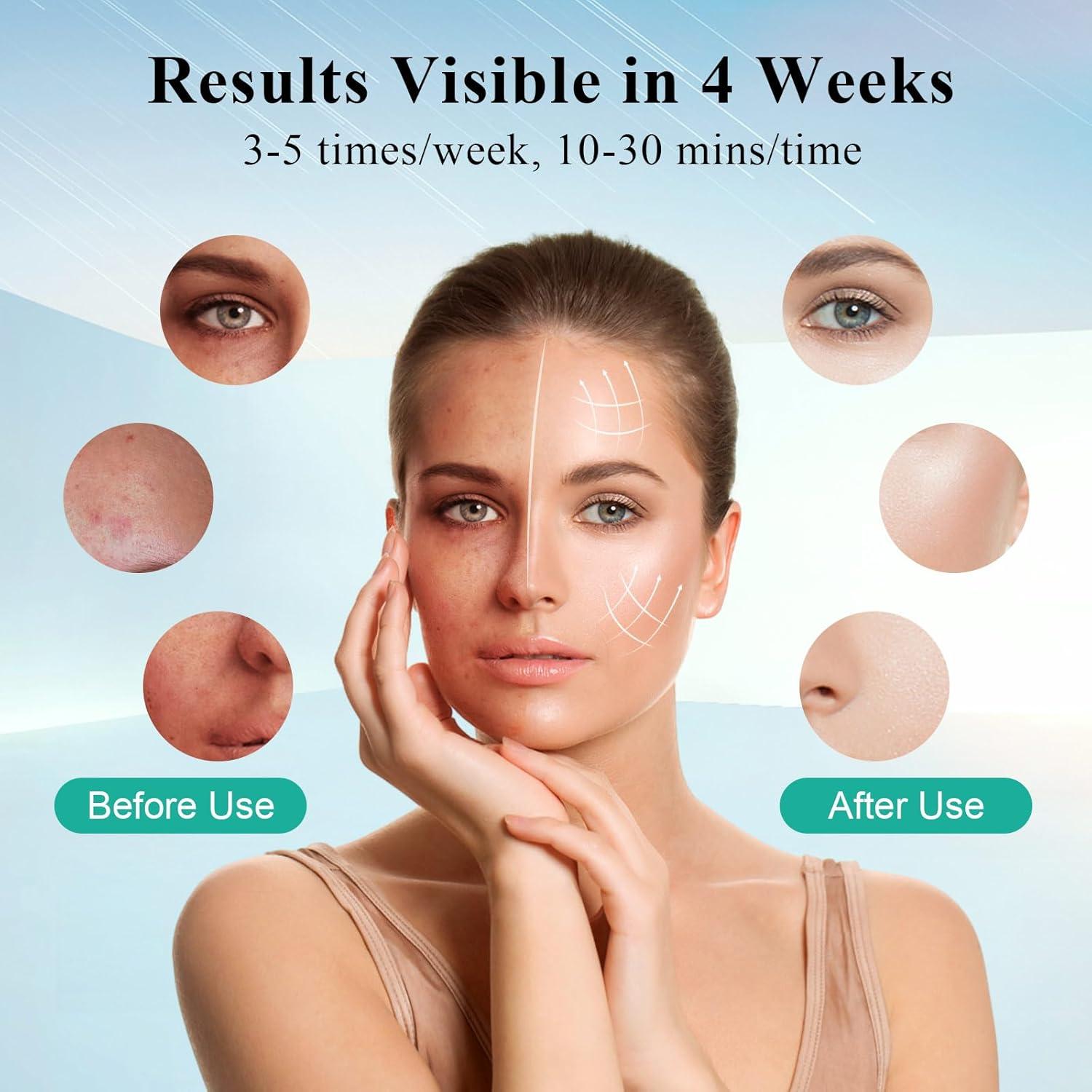 Máscara de Terapia de Luz LED Biuufish 7 Colores Antienvejecimiento