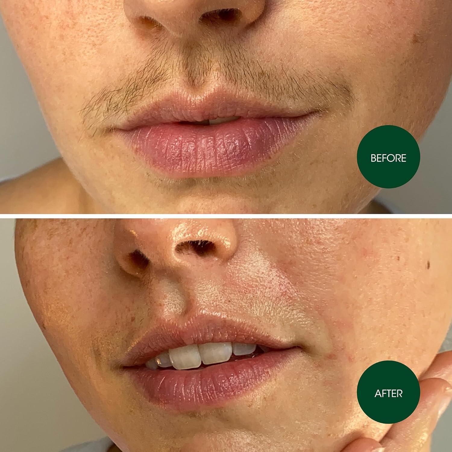 Cintas de Cera Facial Nad's - Hipoalergénicas - 20 Cintas