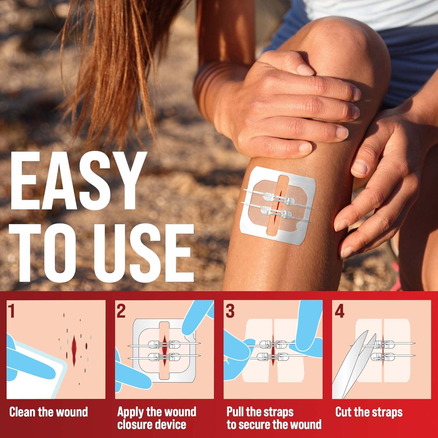 Tiras de Cierre de Heridas MyHelp - 2 Pack - Vendajes en Mariposa