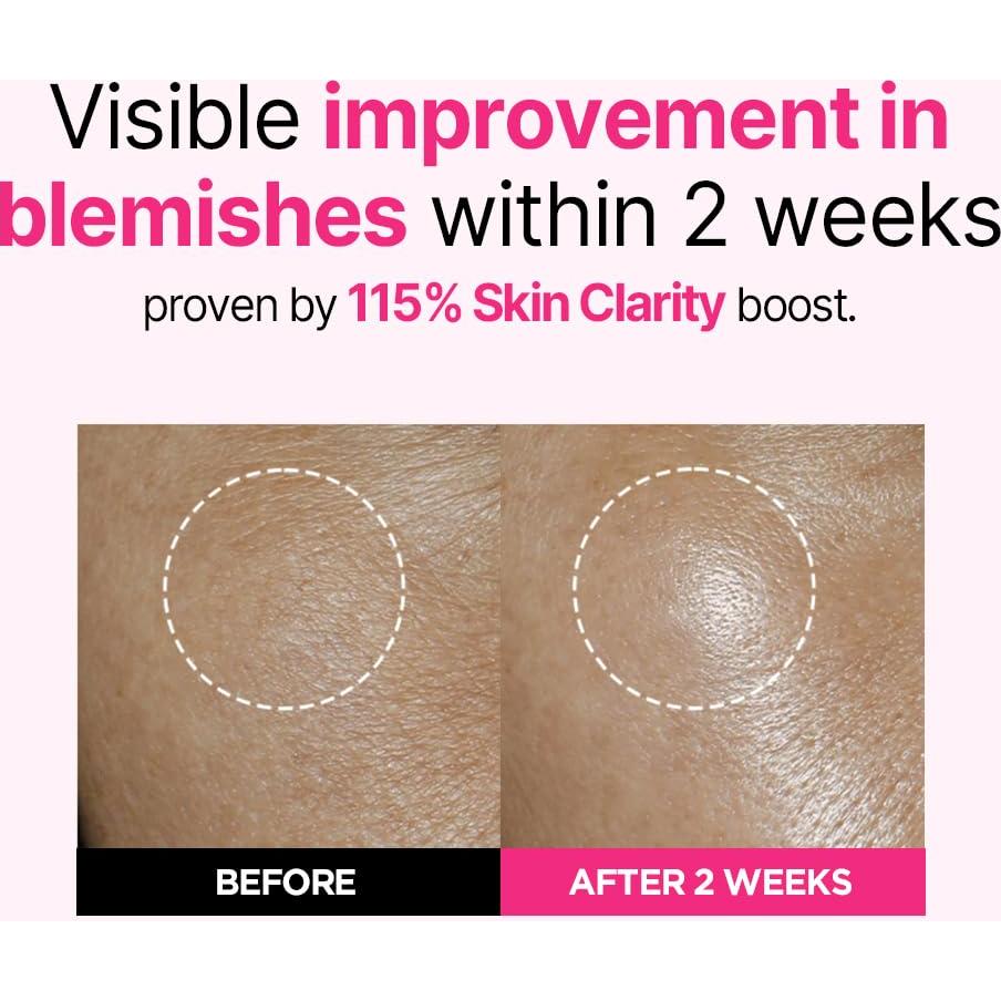 Suero Hidratante Vegano ISOI Blemish Care 25ml - Piel Lisa y Radiante