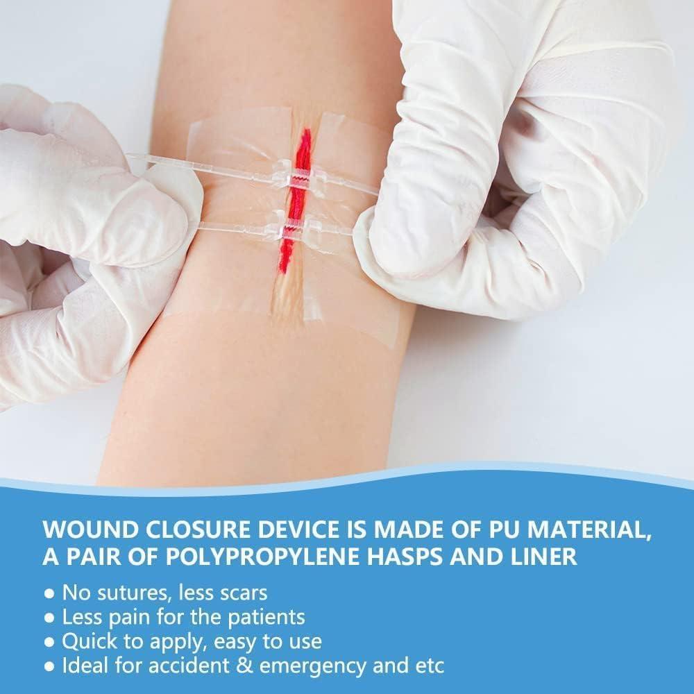 Cinta de Cierre de Heridas FORKANG Tipo A 2.4x2.8" 2 PCS