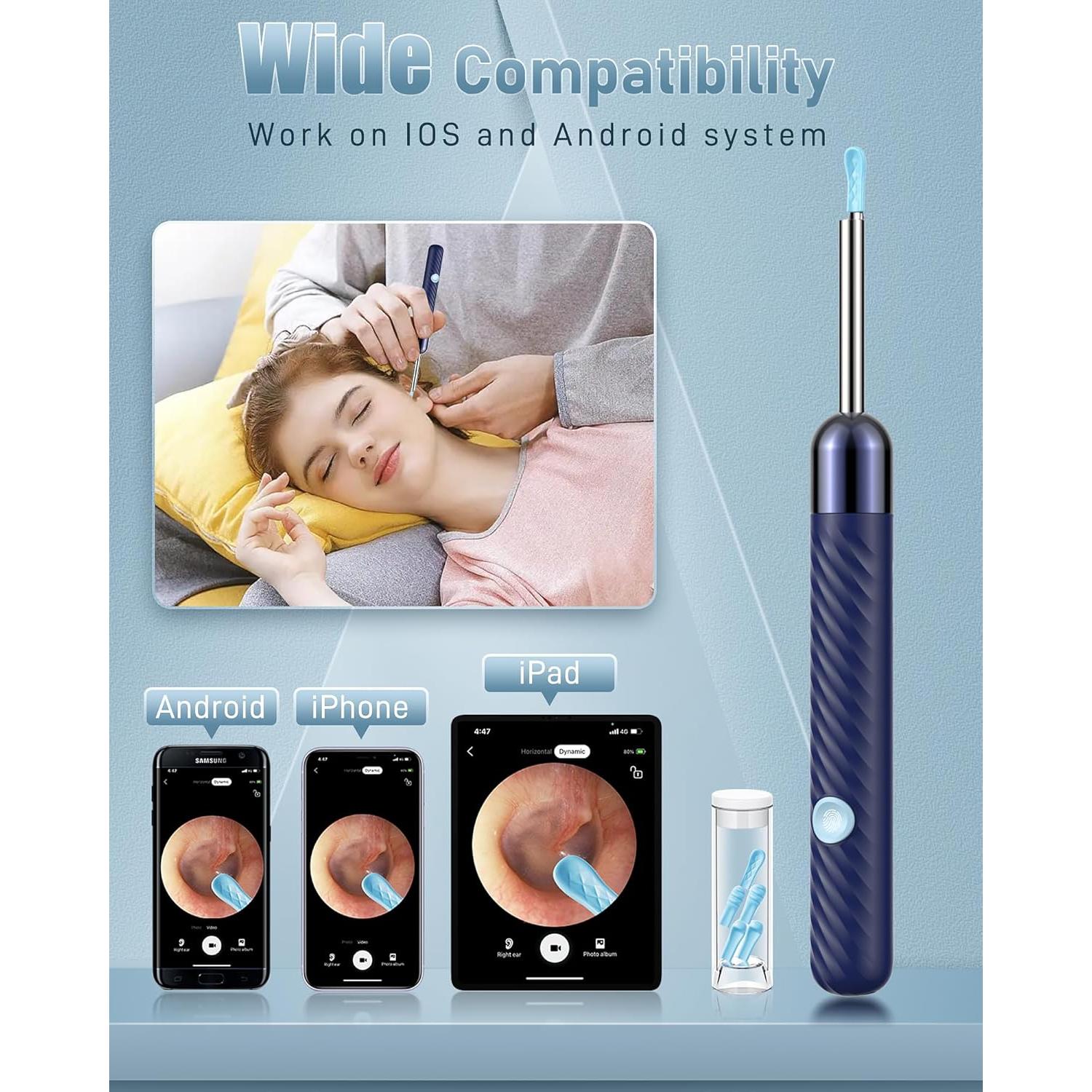 Limpiador de Oídos Kolrry con Cámara HD 1080P y 6 Cucharas