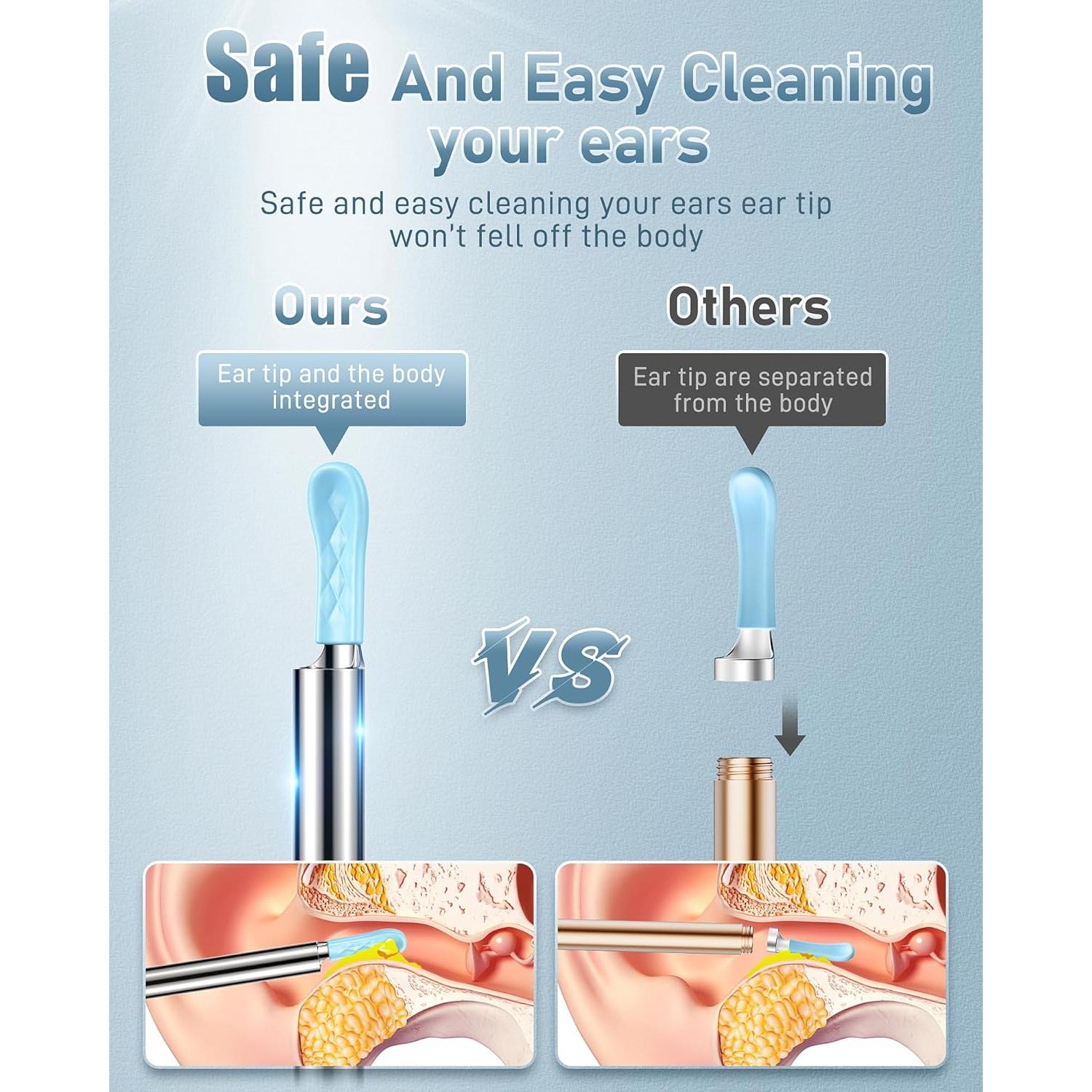 Limpiador de Oídos Kolrry con Cámara HD 1080P y 6 Cucharas