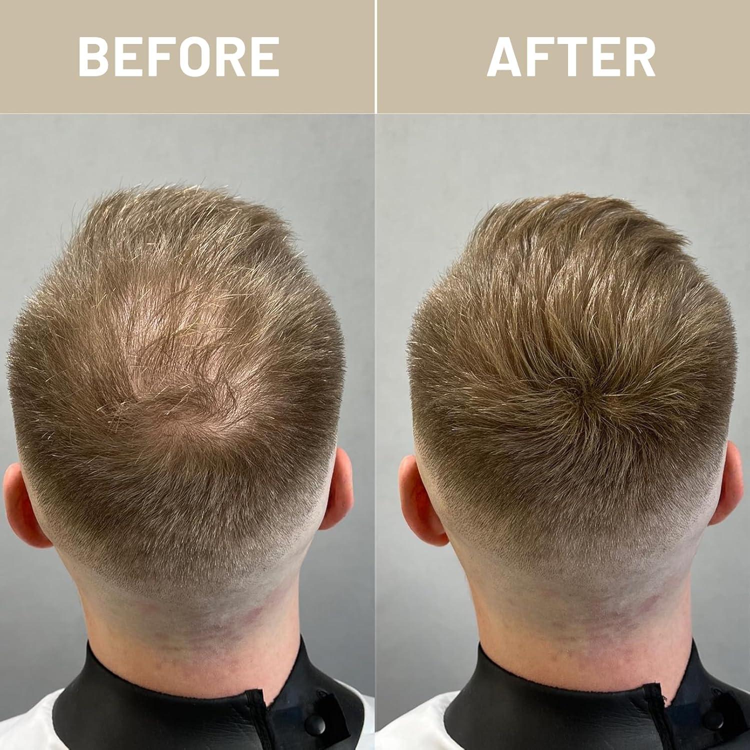 Fibras para Cabello VOLLUCK 28g Castaño Rojizo - Cobertura Instantánea