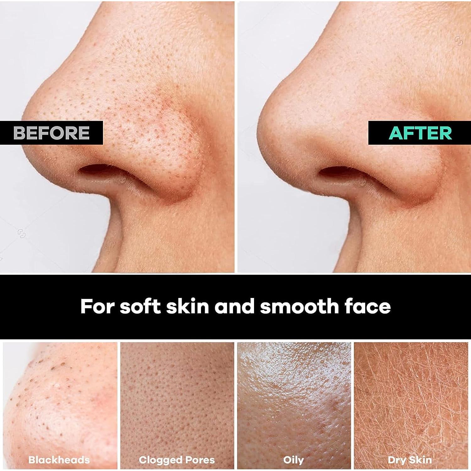 Mitón Exfoliante Facial Dermasuri - Limpiador Profundo 1 Cuenta