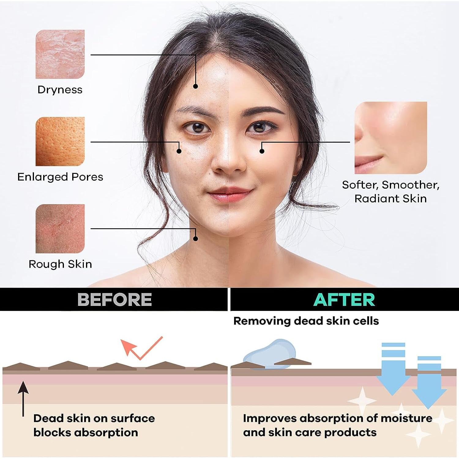 Mitón Exfoliante Facial Dermasuri - Limpiador Profundo 1 Cuenta